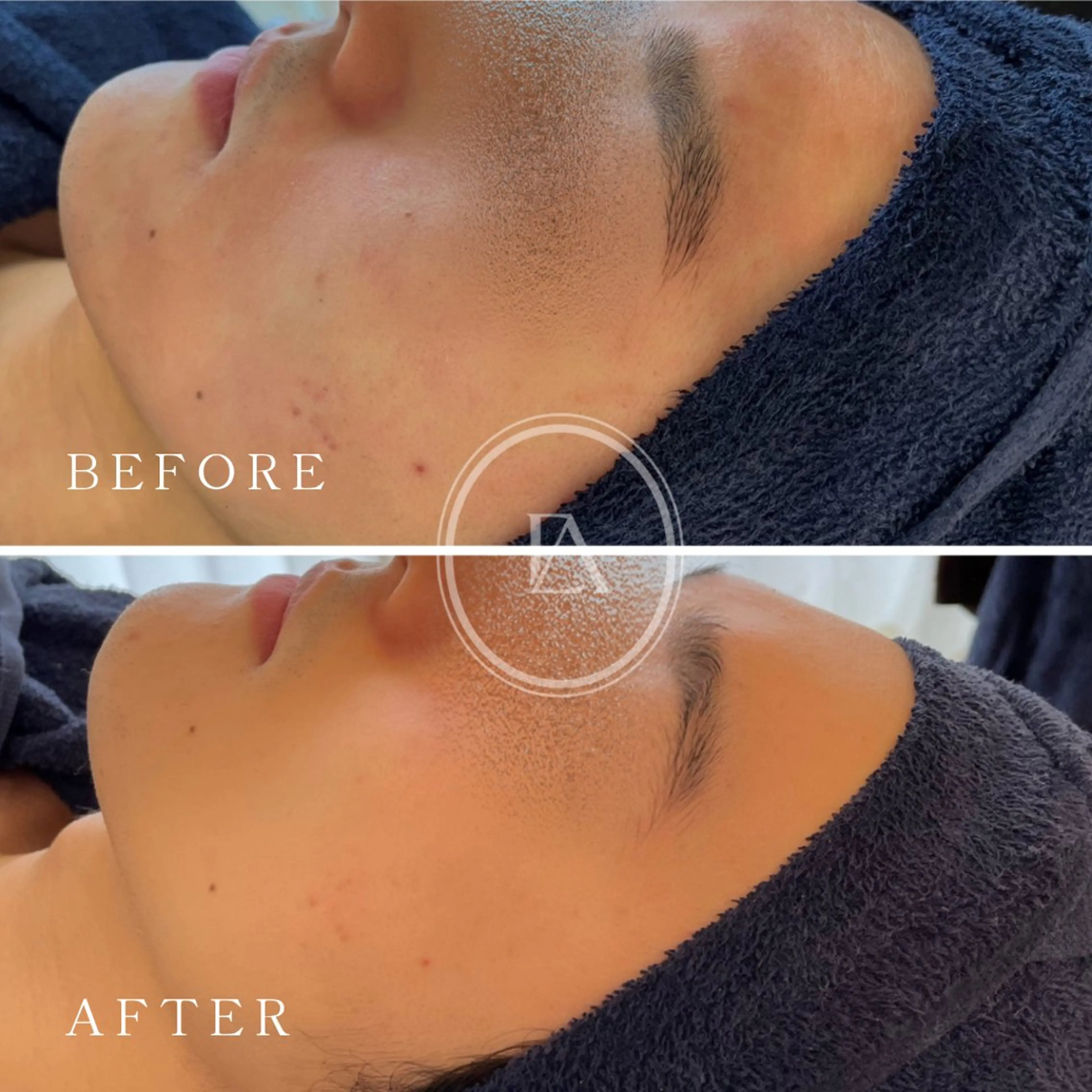 エステ エストリア 所沢店のエステ・リラクイメージ