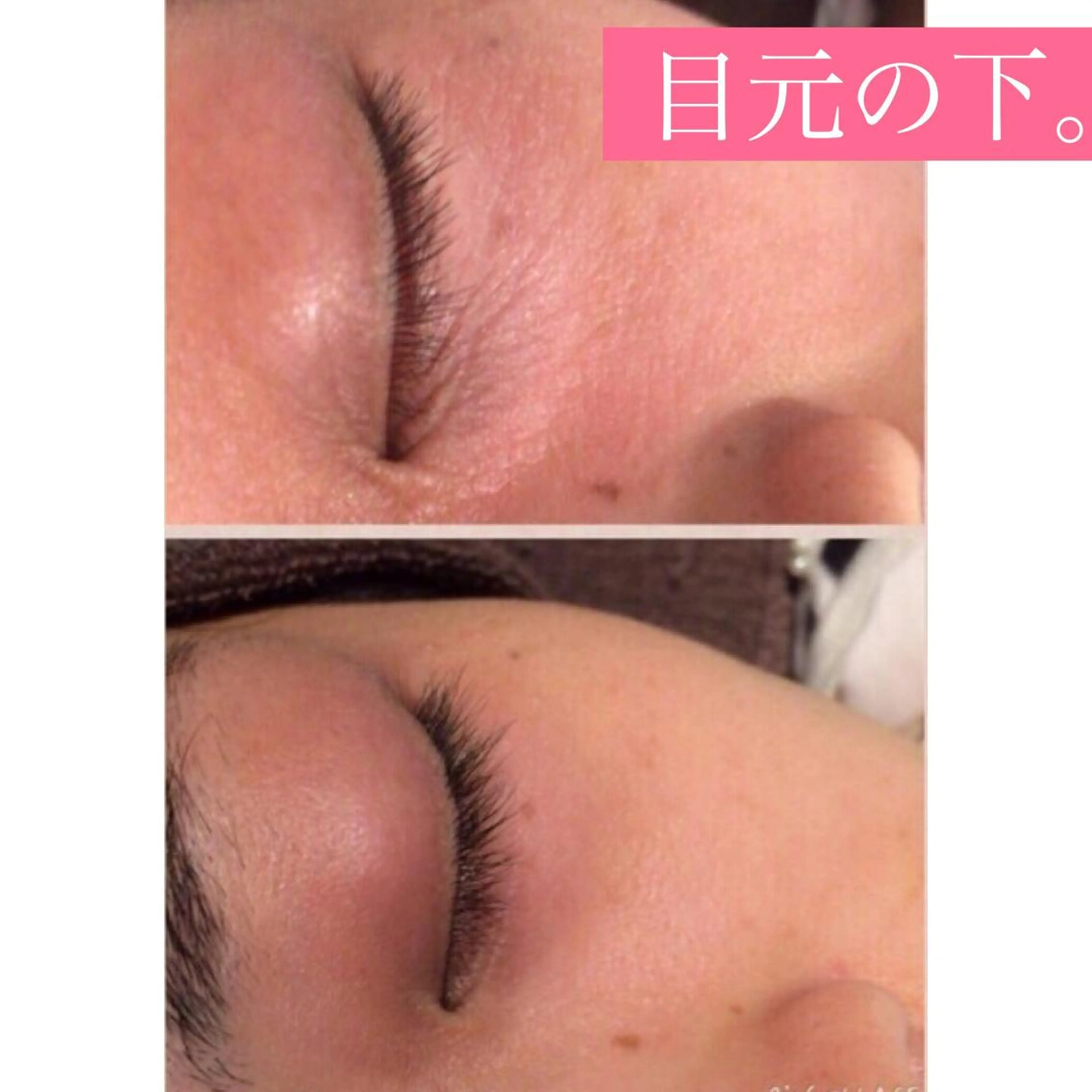 セミロング カラー パーマ ヘアアレンジ メンズ キッズ ネイル マツエク・マツパ 四つ星サロン🎖 腸＆ニキビケアに特化のエステ・リラクイメージ