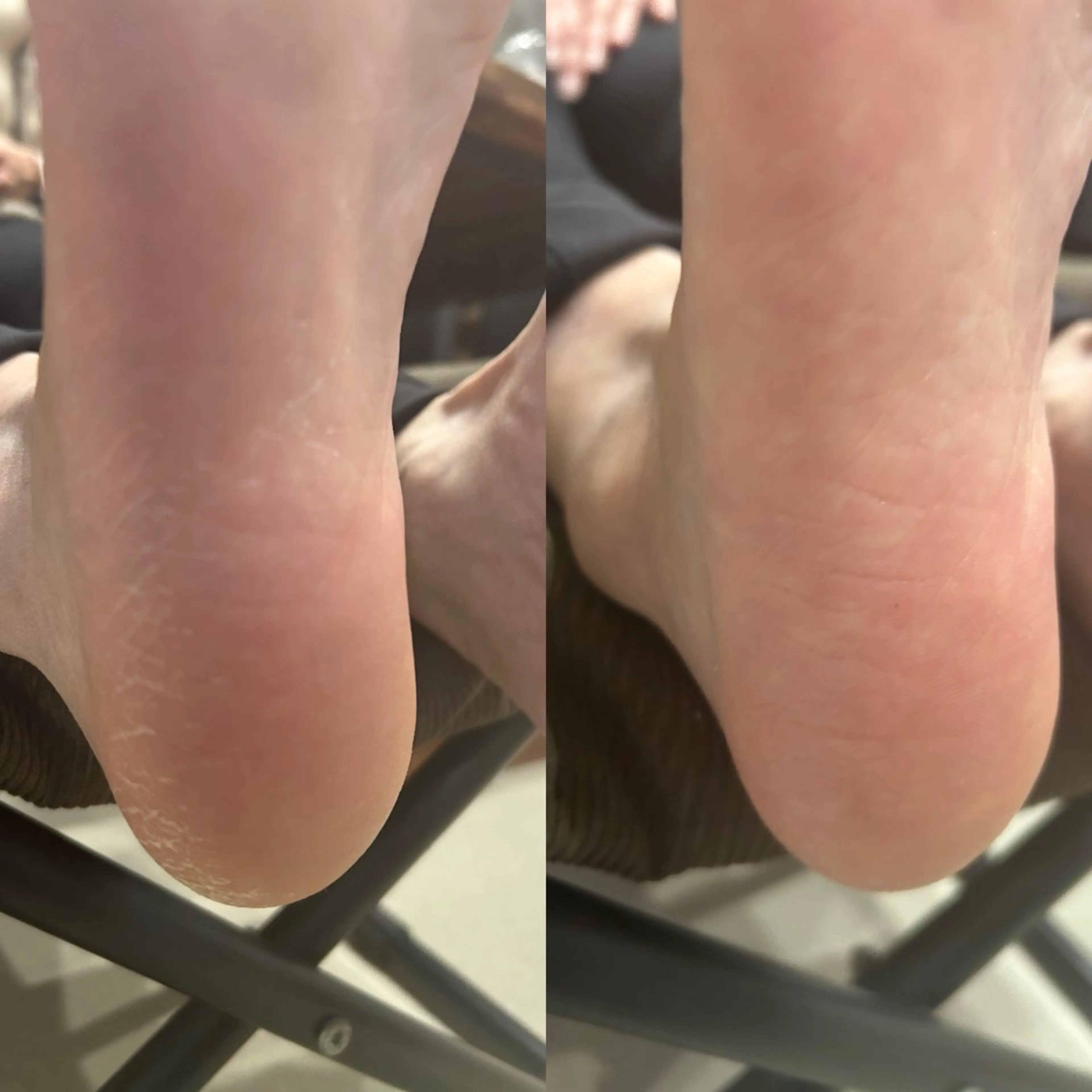 🧡角質フットケア🧡の写真