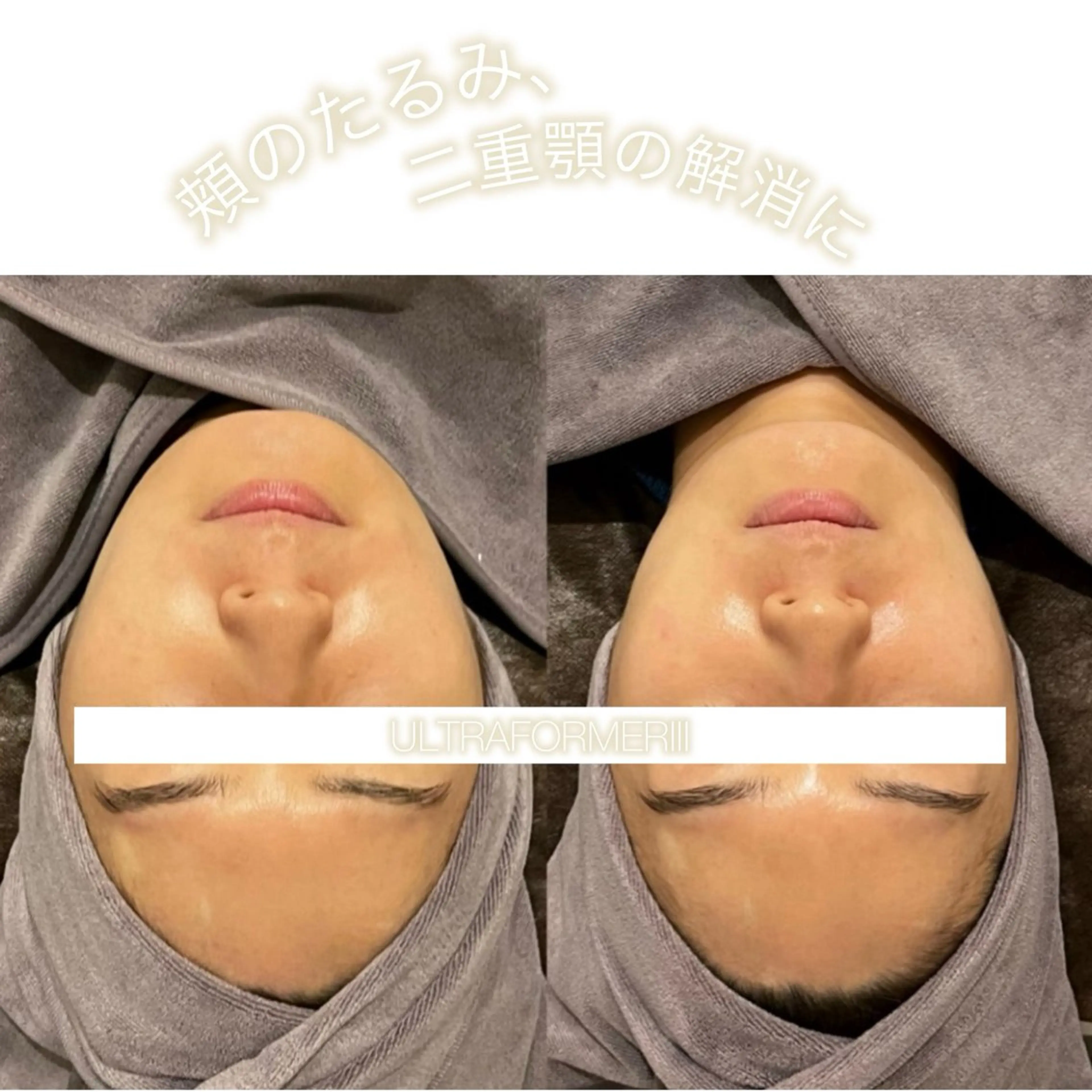 エステ ☆痩身/小顔☆ 結果出します☆のエステ・リラクイメージ