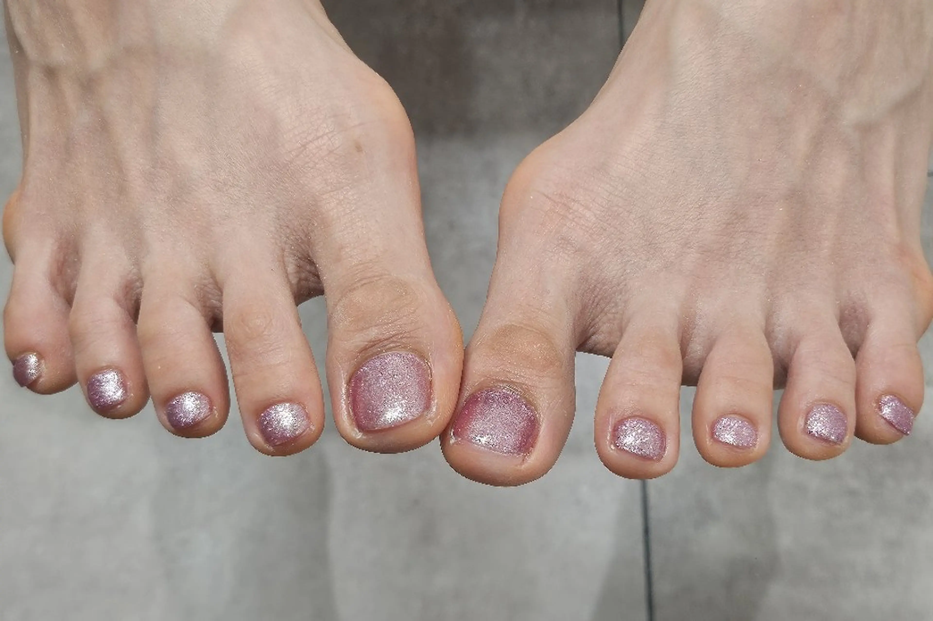 ネイル ラメ(グリッター) ピンク ネイルドイット【Nailed it!】所属・Murakami Akaneのネイルデザイン