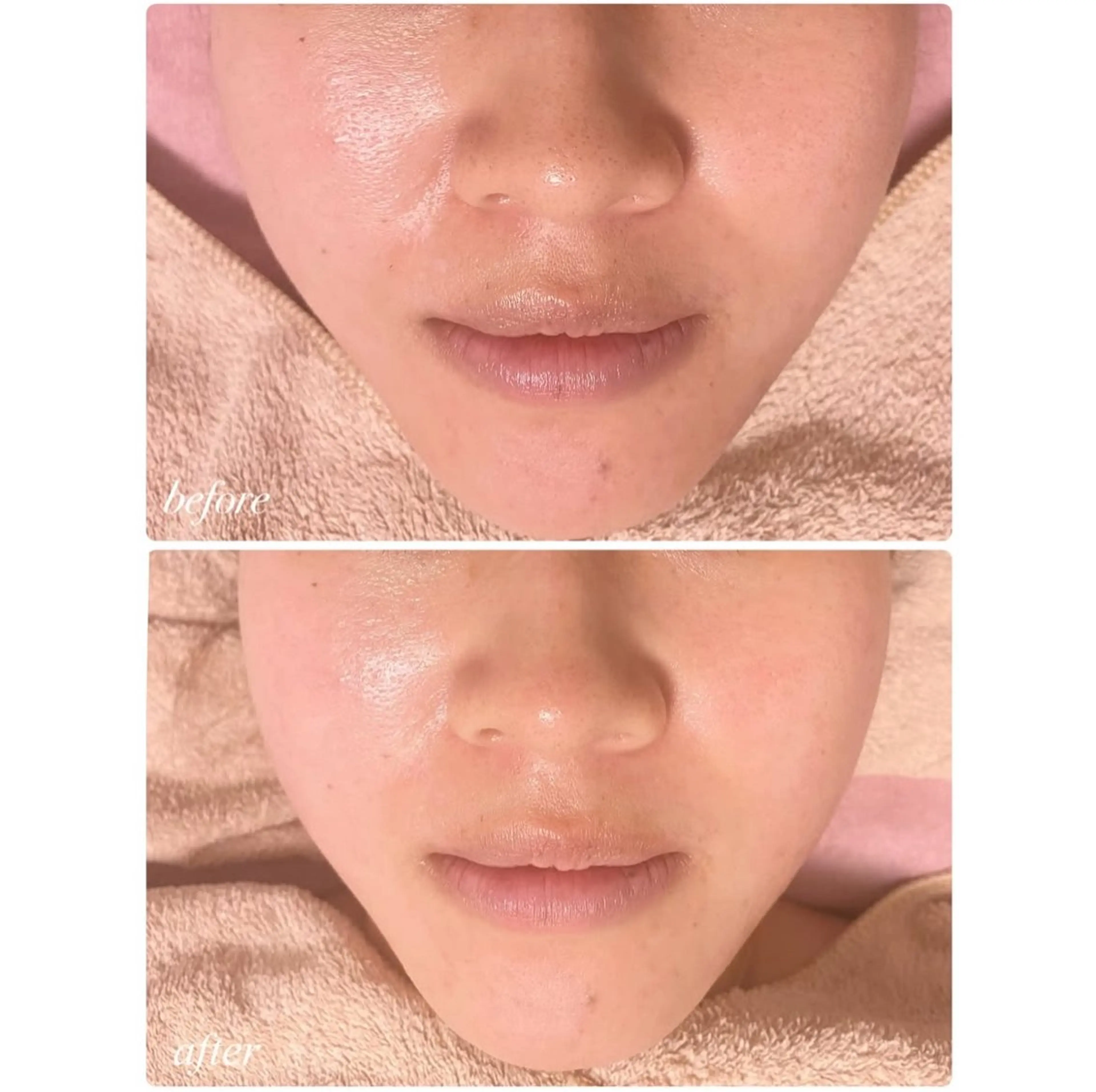 La Colzaのネイルデザイン