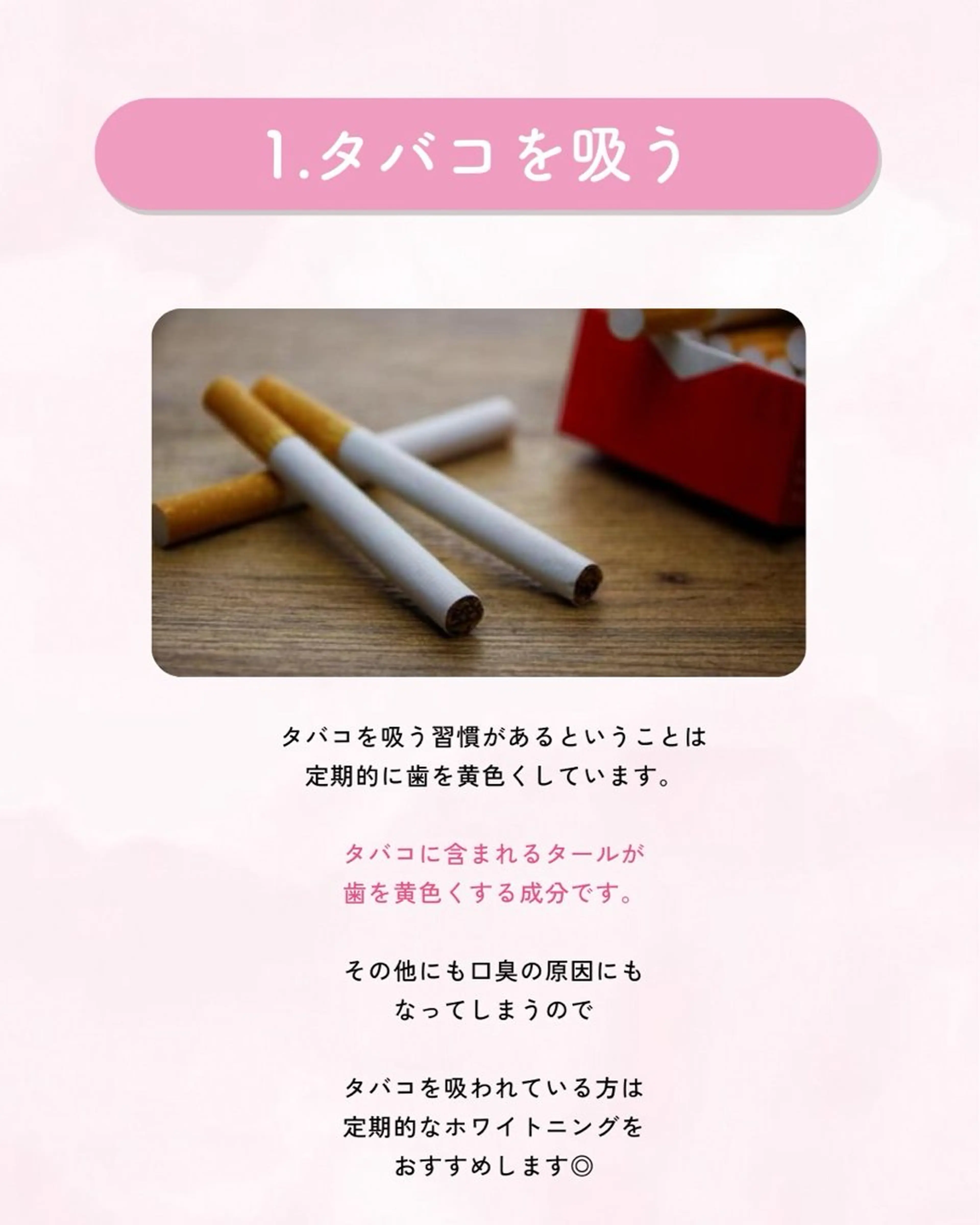 セルフホワイトニング エクシア大曽根店のその他イメージ