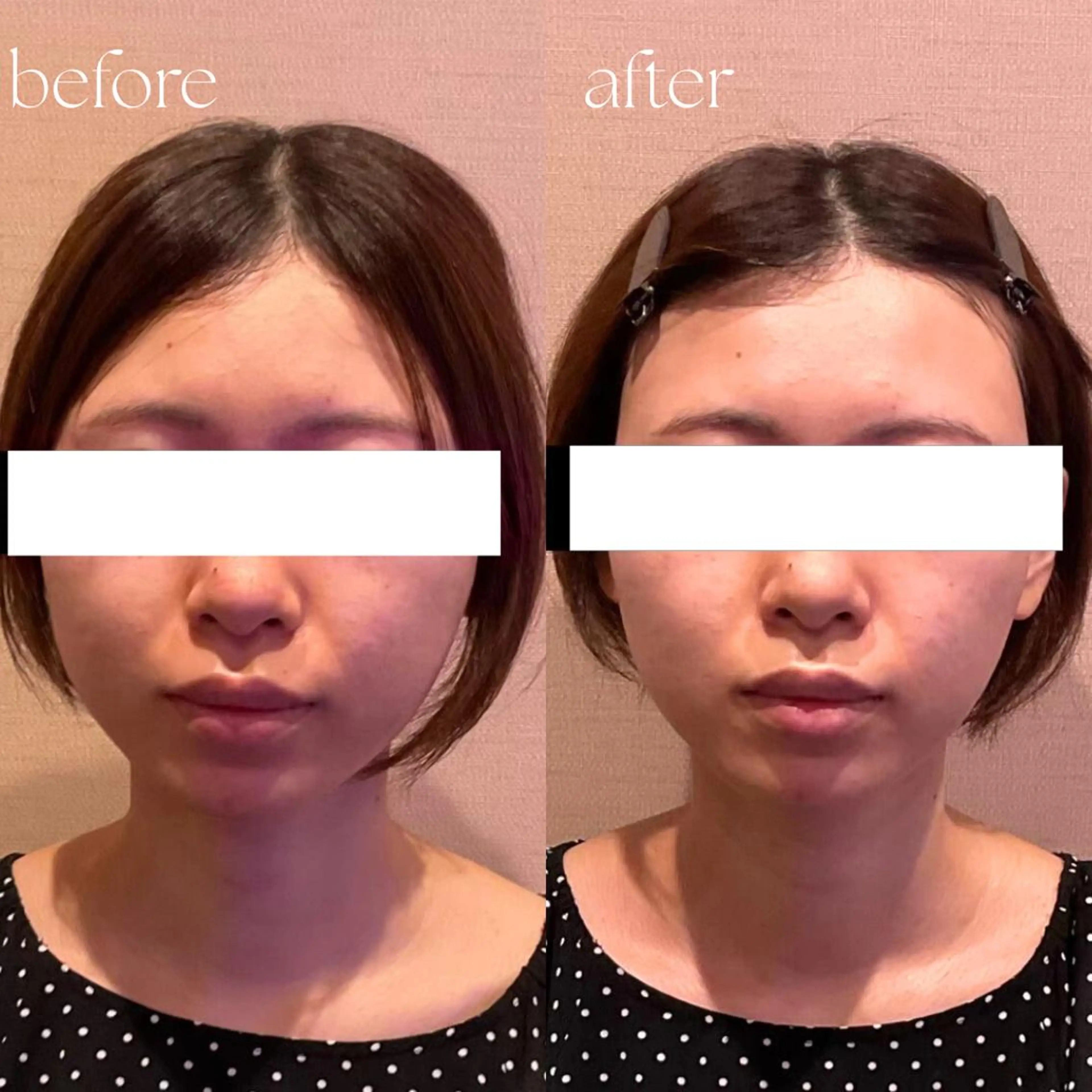 エステ リラク B-st. 下北沢のエステ・リラクイメージ