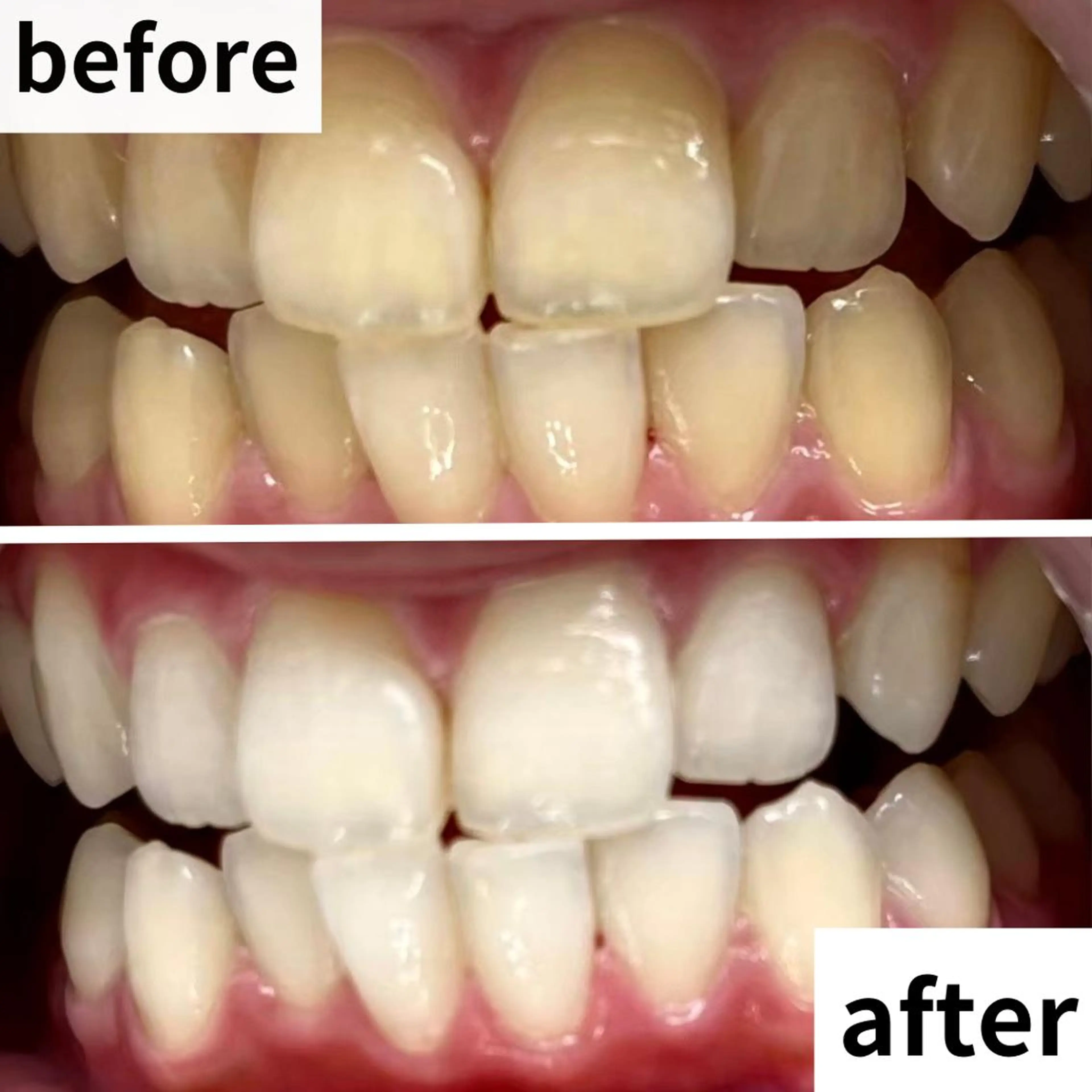 エステ リラク LBSホワイトニング 🌐渋谷店 河内のエステ・リラクイメージ