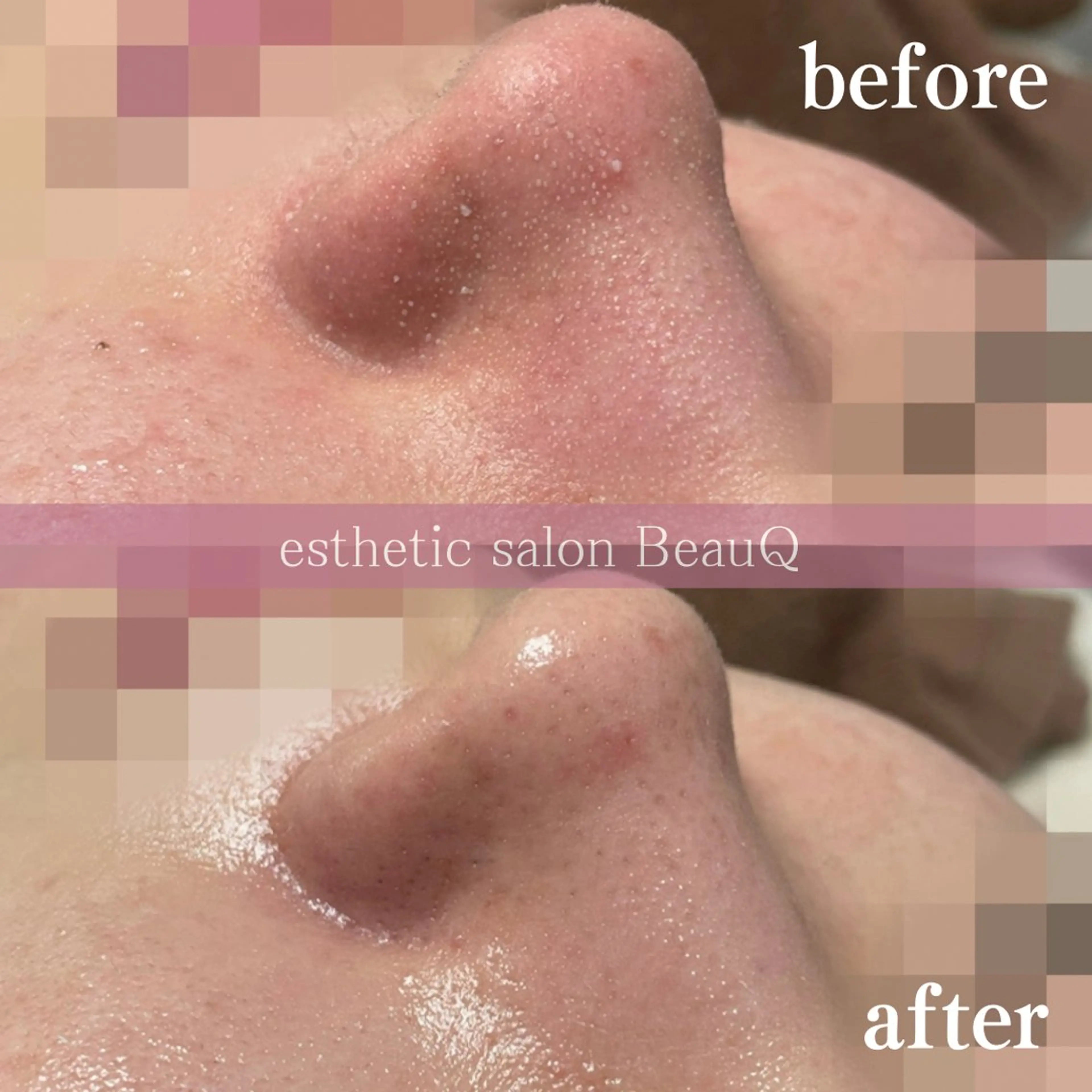 肌質改善/ブライダル 水上百華のエステ・リラクイメージ