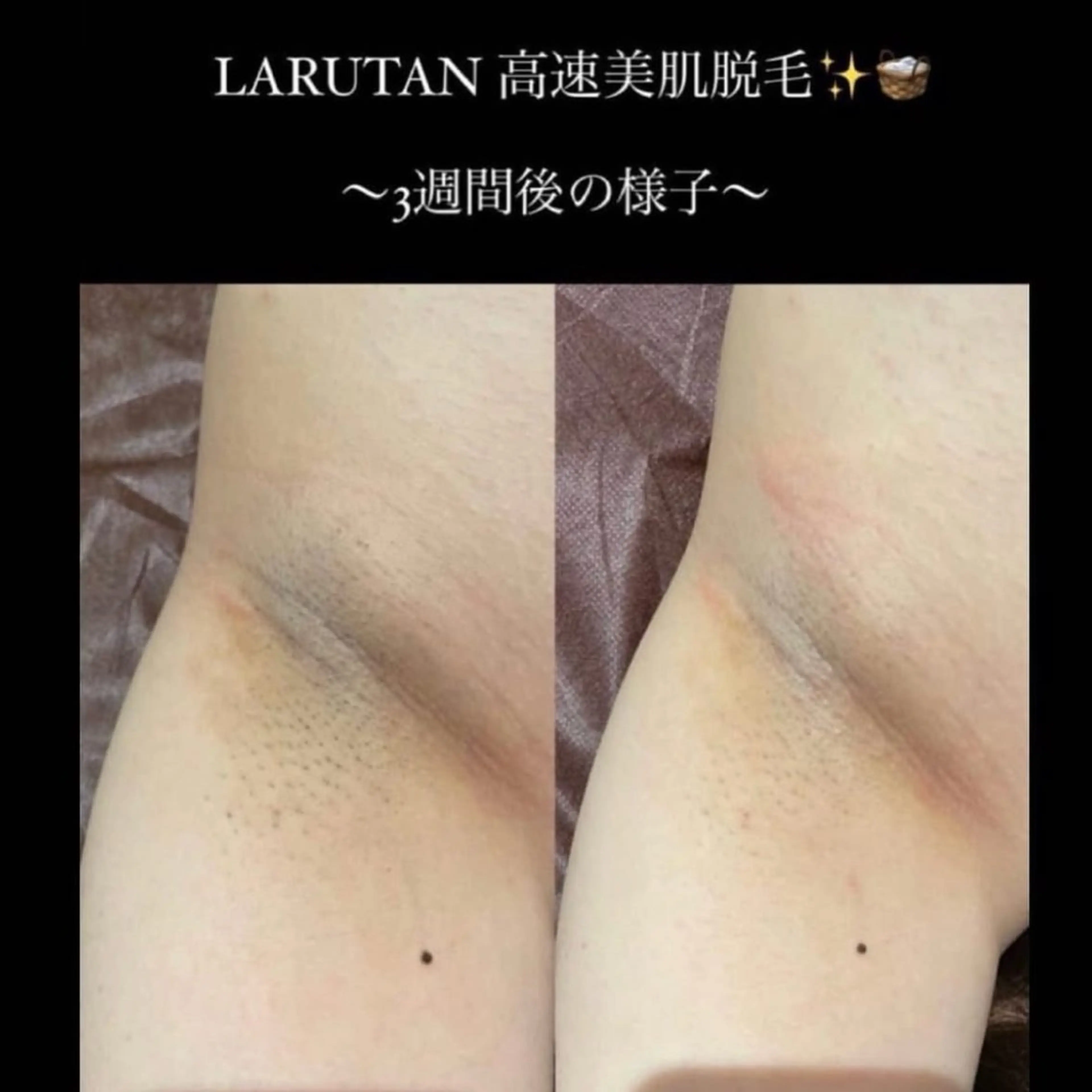 LARUTAN所属・エステ・脱毛 LARUTANのエステ・リラクイメージ