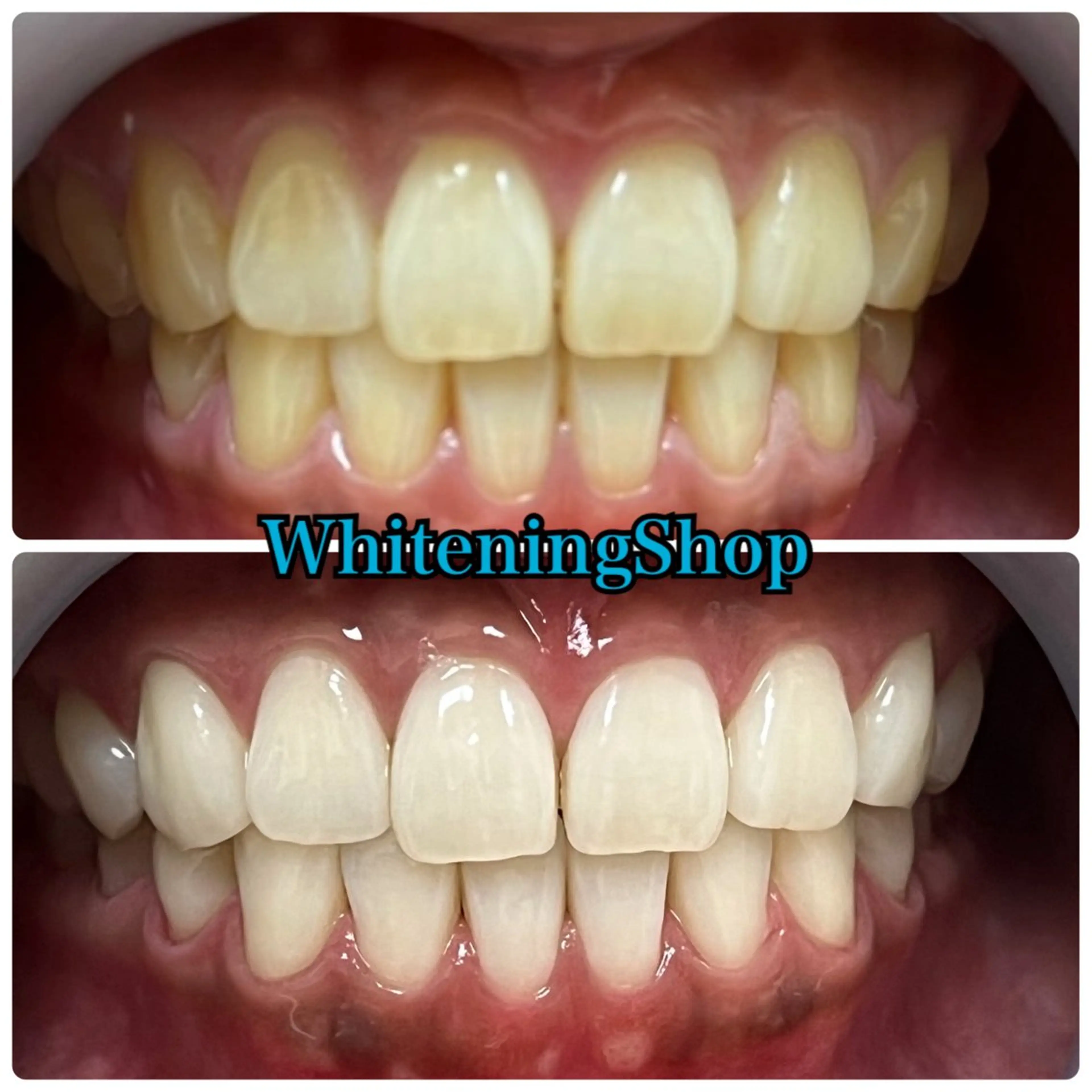 エステ リラク ホワイトニング ショップ吉祥寺店のエステ・リラクイメージ