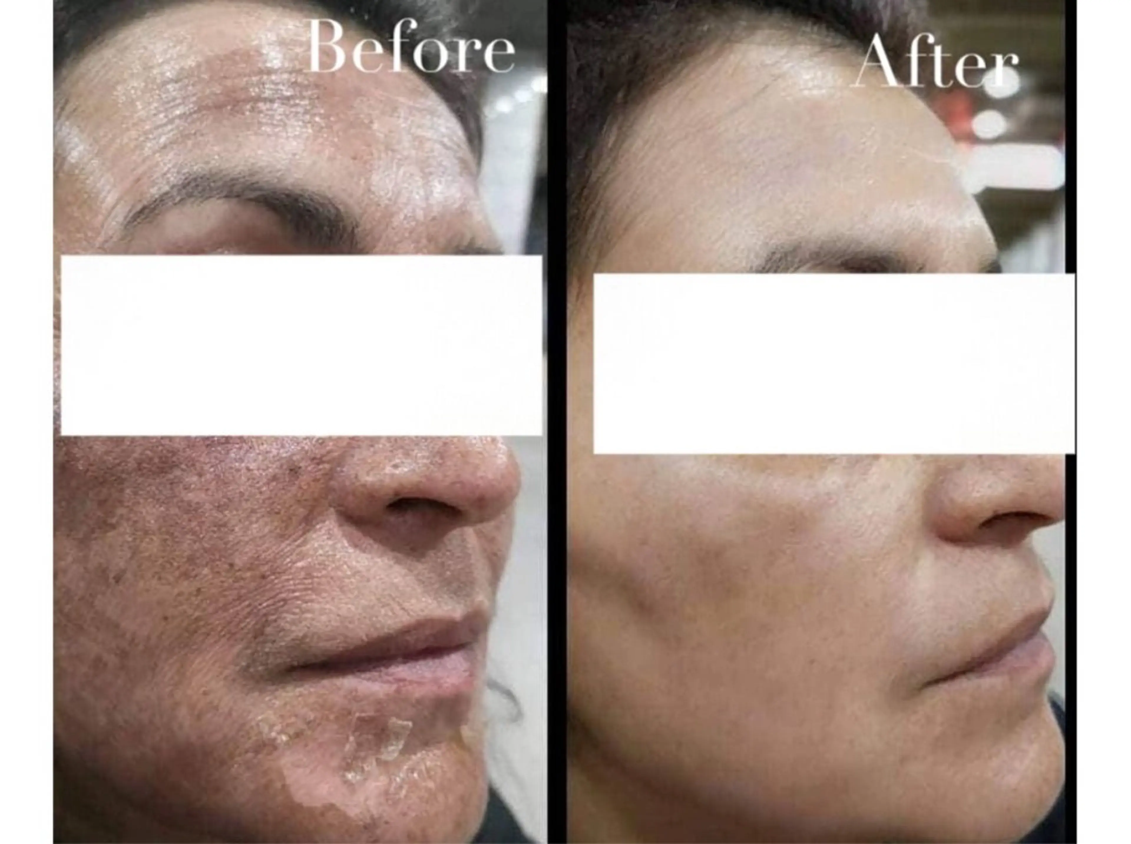 エステ Avenir Brillant所属・松田 紗季のエステ・リラクイメージ