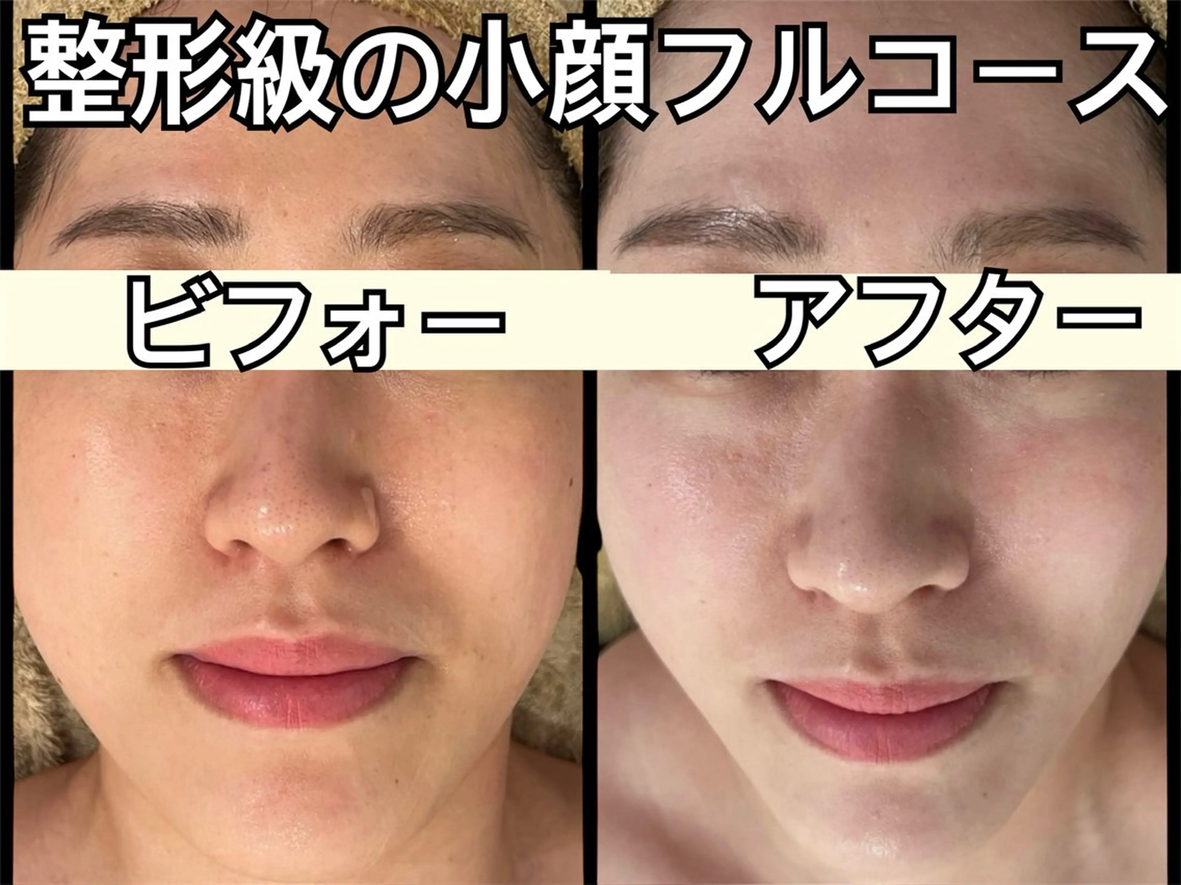 小顔専門看護師クリニカルサロンCOCO所属・小顔と美肌サロン クリニカルサロンココのエステ・リラクイメージ