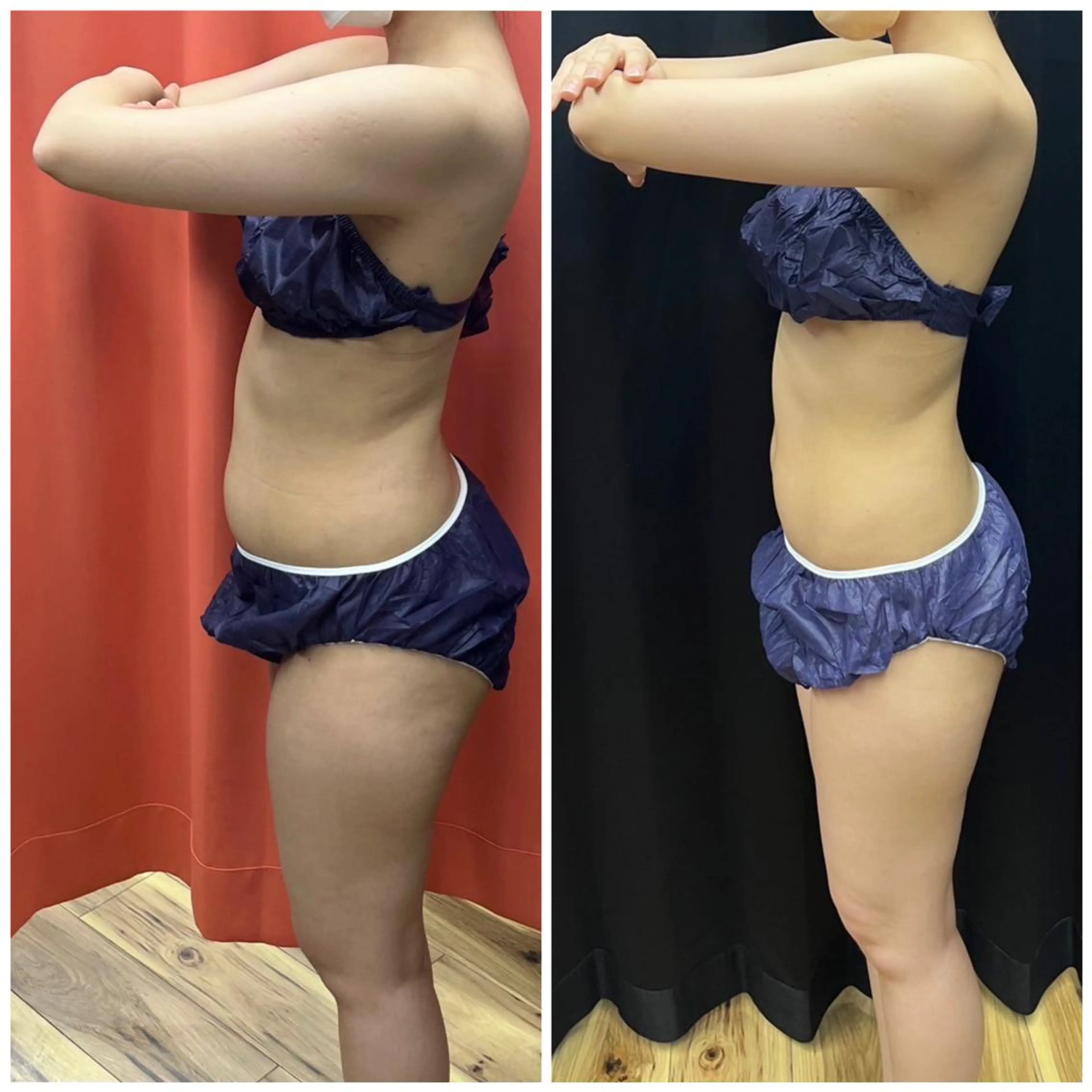 【姿勢矯正/痩身】痩せる身体造り❣️巻いて寝るだけFTI 全身の写真