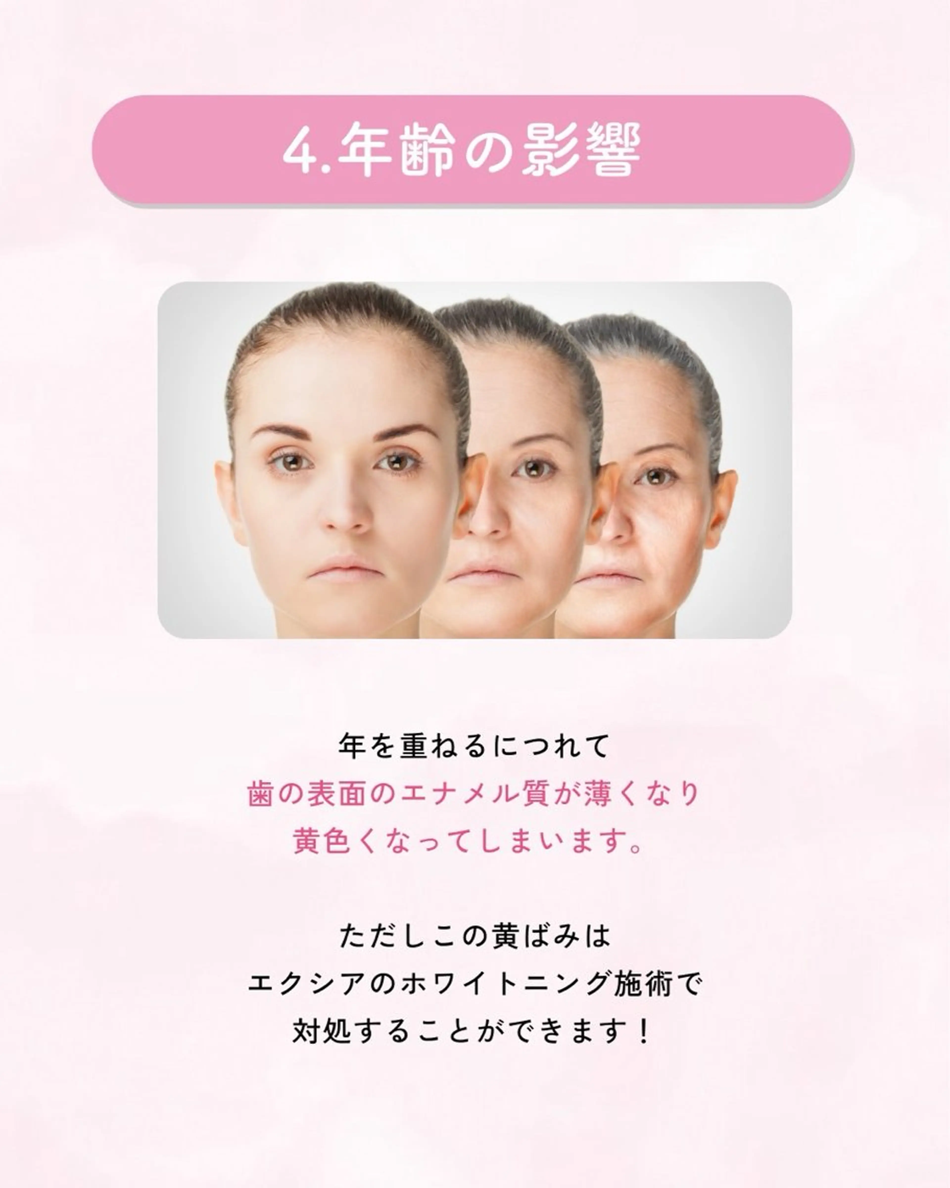 セルフホワイトニング エクシア大曽根店のその他イメージ