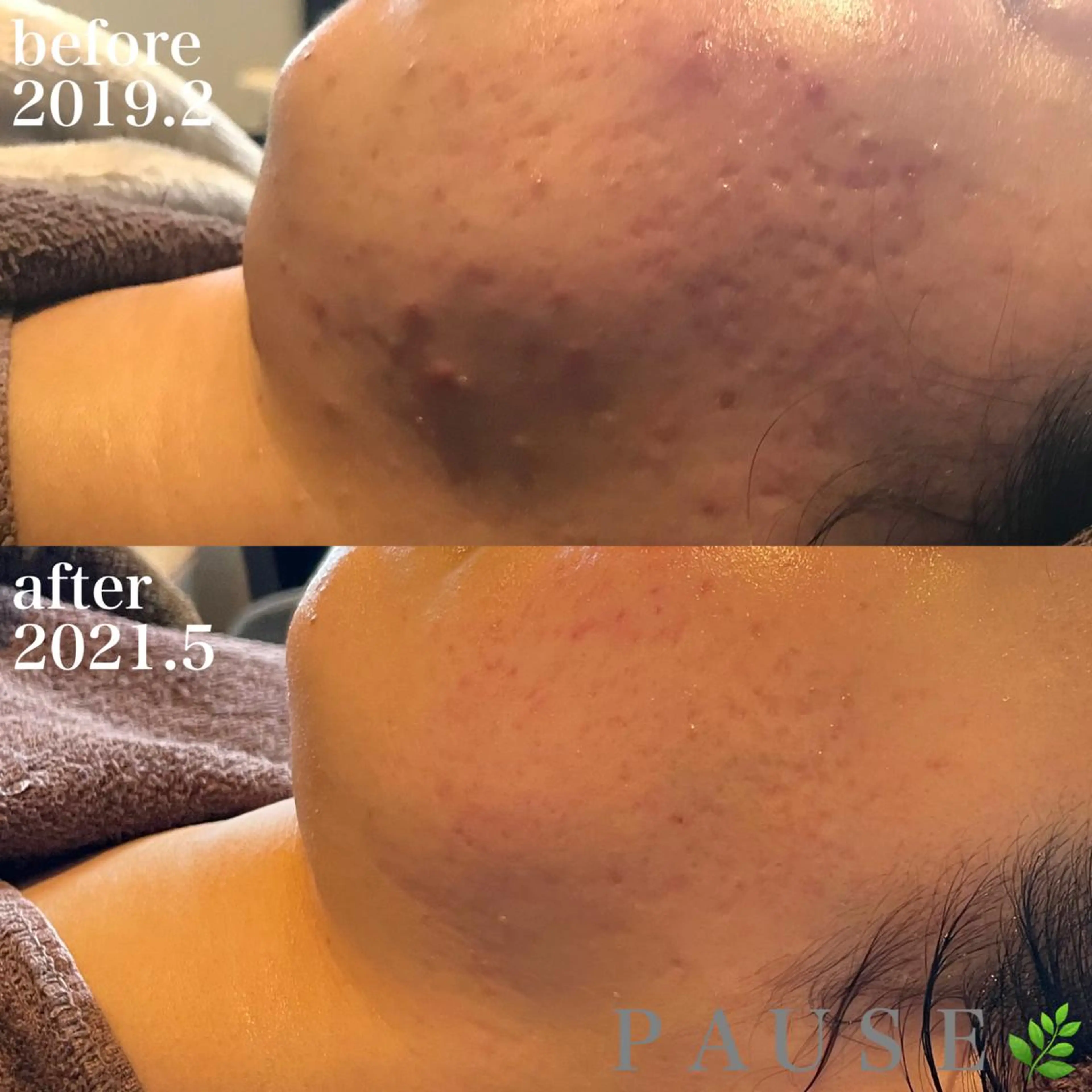 エステ 浜野 恵美のエステ・リラクイメージ