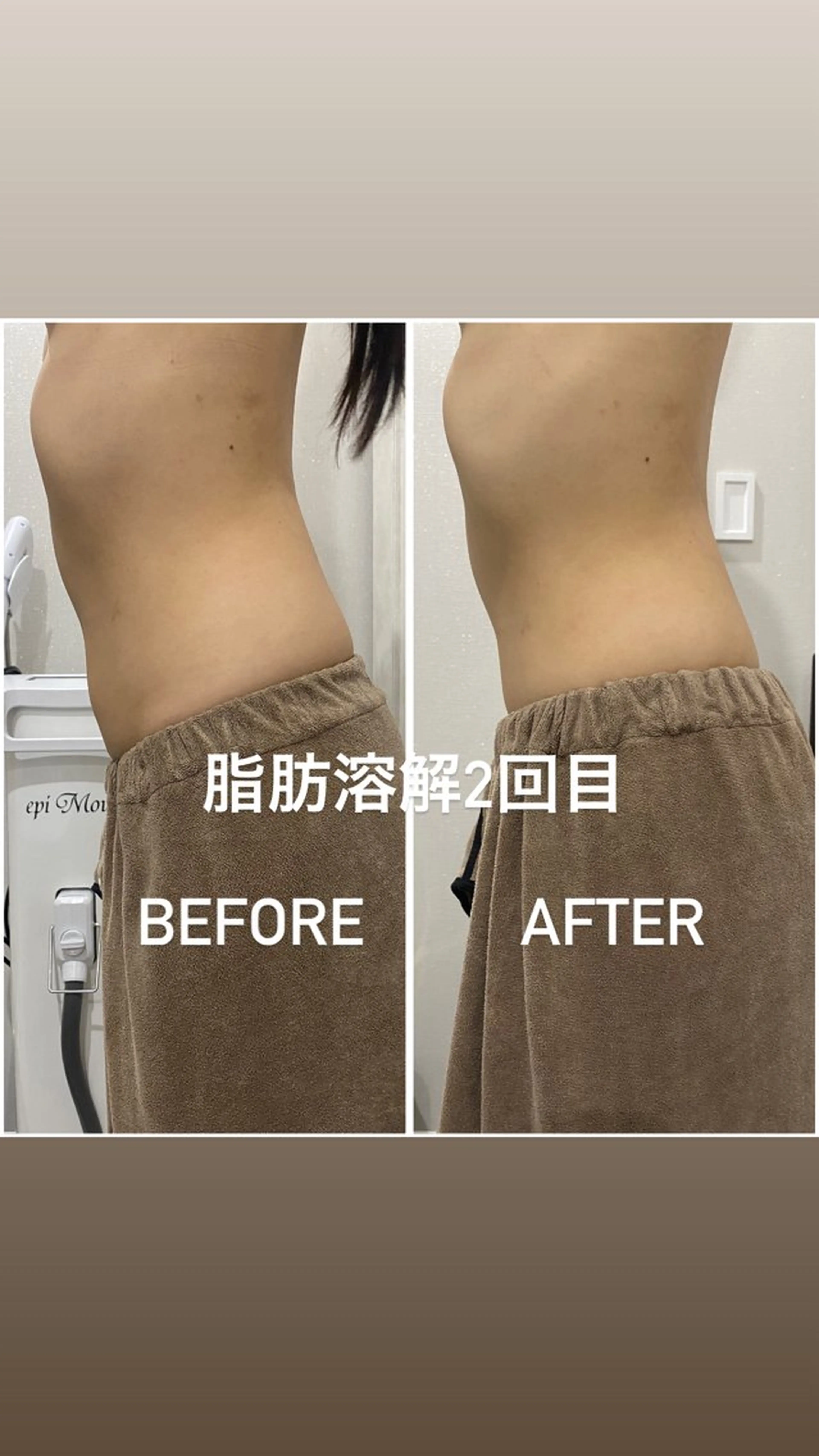 エステ 毛穴洗浄・痩身・脱毛 /アルカンジュのエステ・リラクイメージ