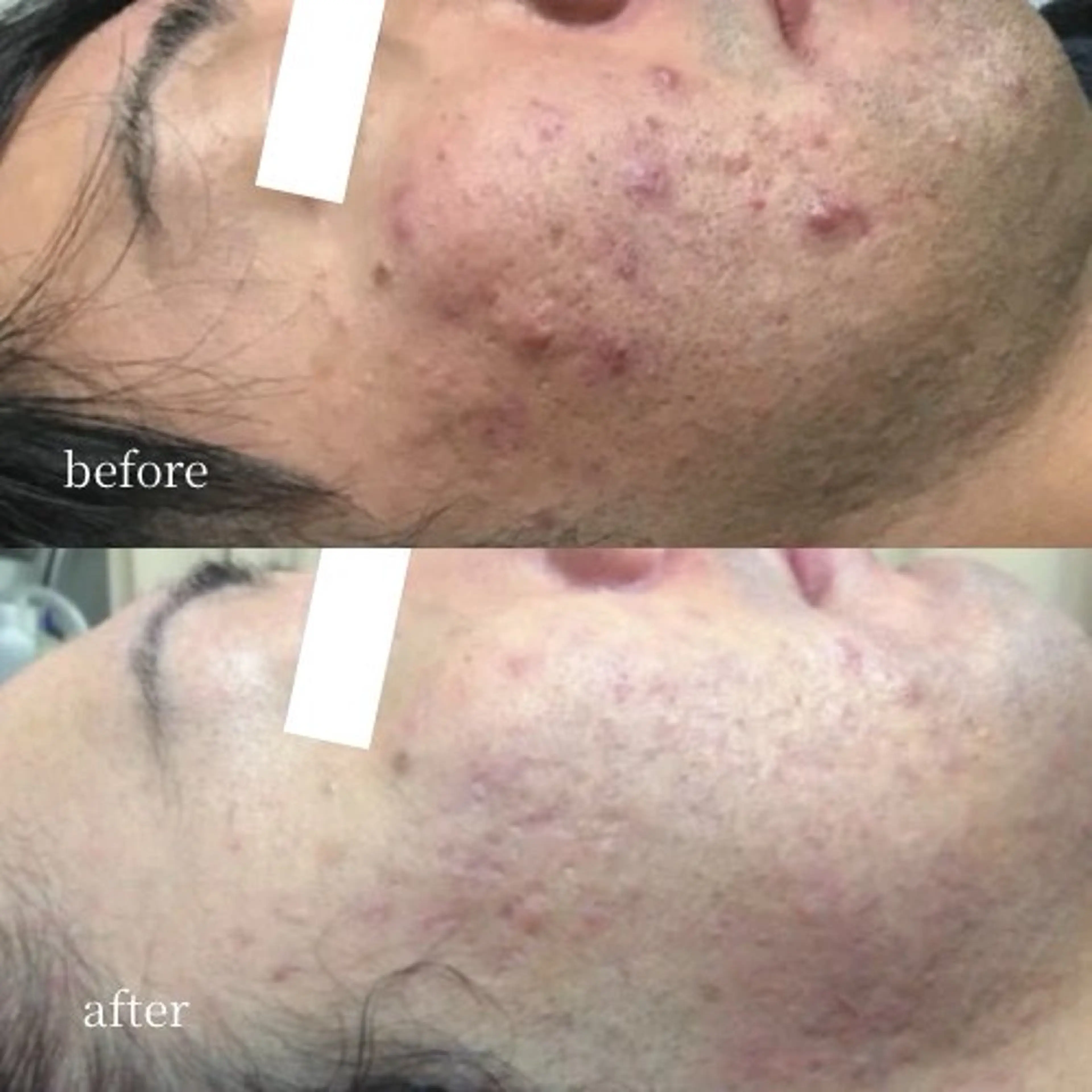 エステ 【韓国人肌製作所】 水光肌ならアーネストのエステ・リラクイメージ