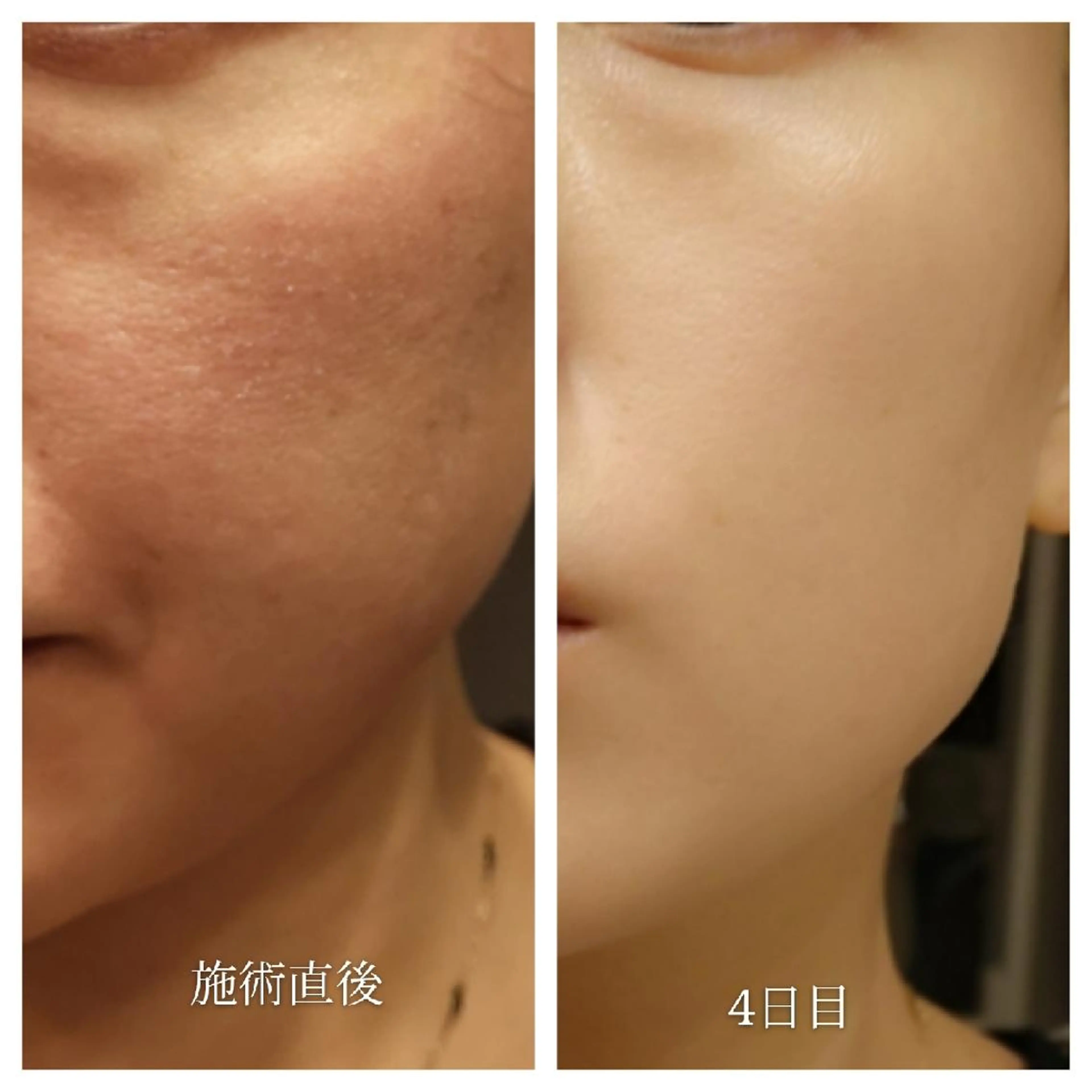 🅖🅤🅩🅔🅛 salonのエステ・リラクイメージ