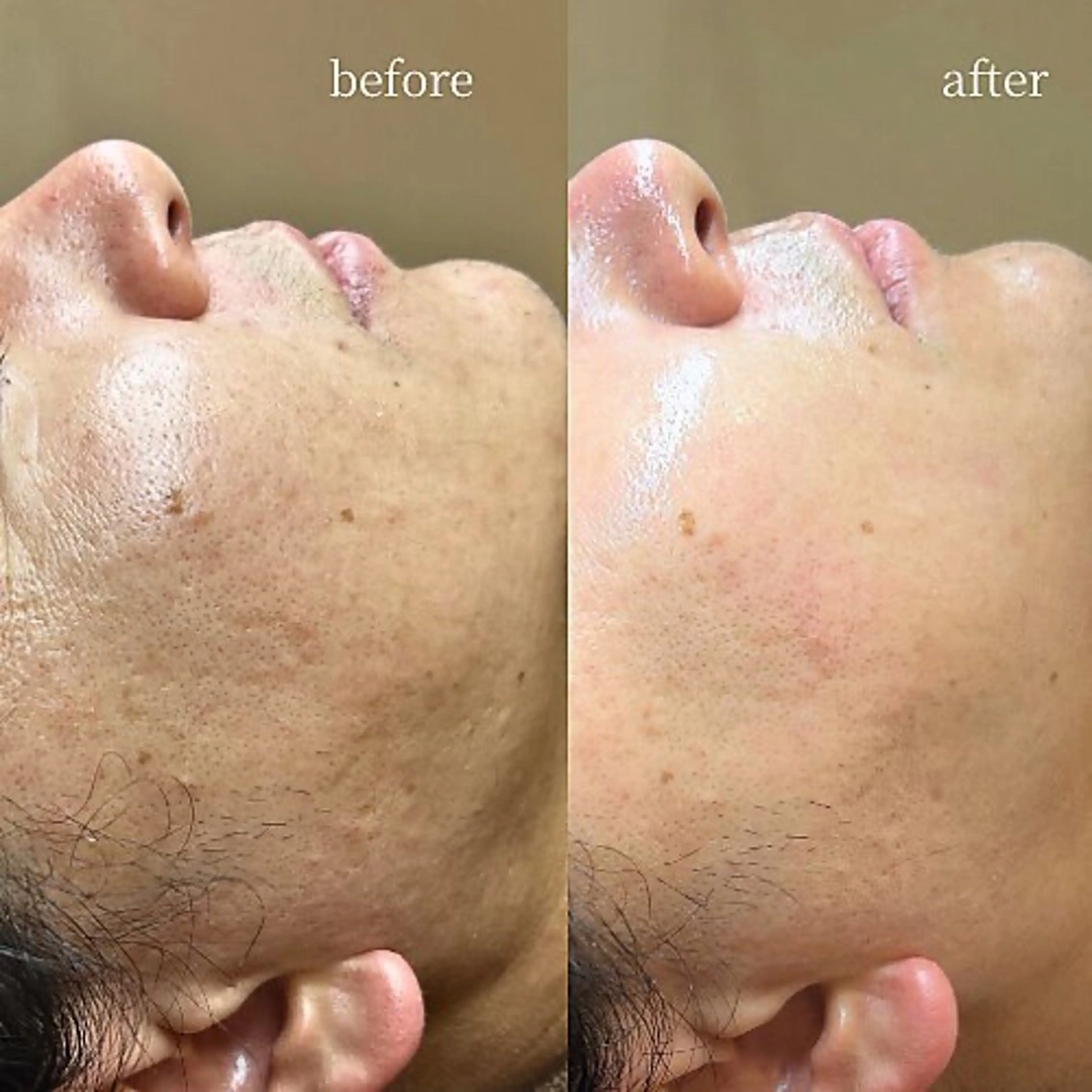 エステ 韓国肌管理・肌質改善 EARNEST心斎橋のエステ・リラクイメージ