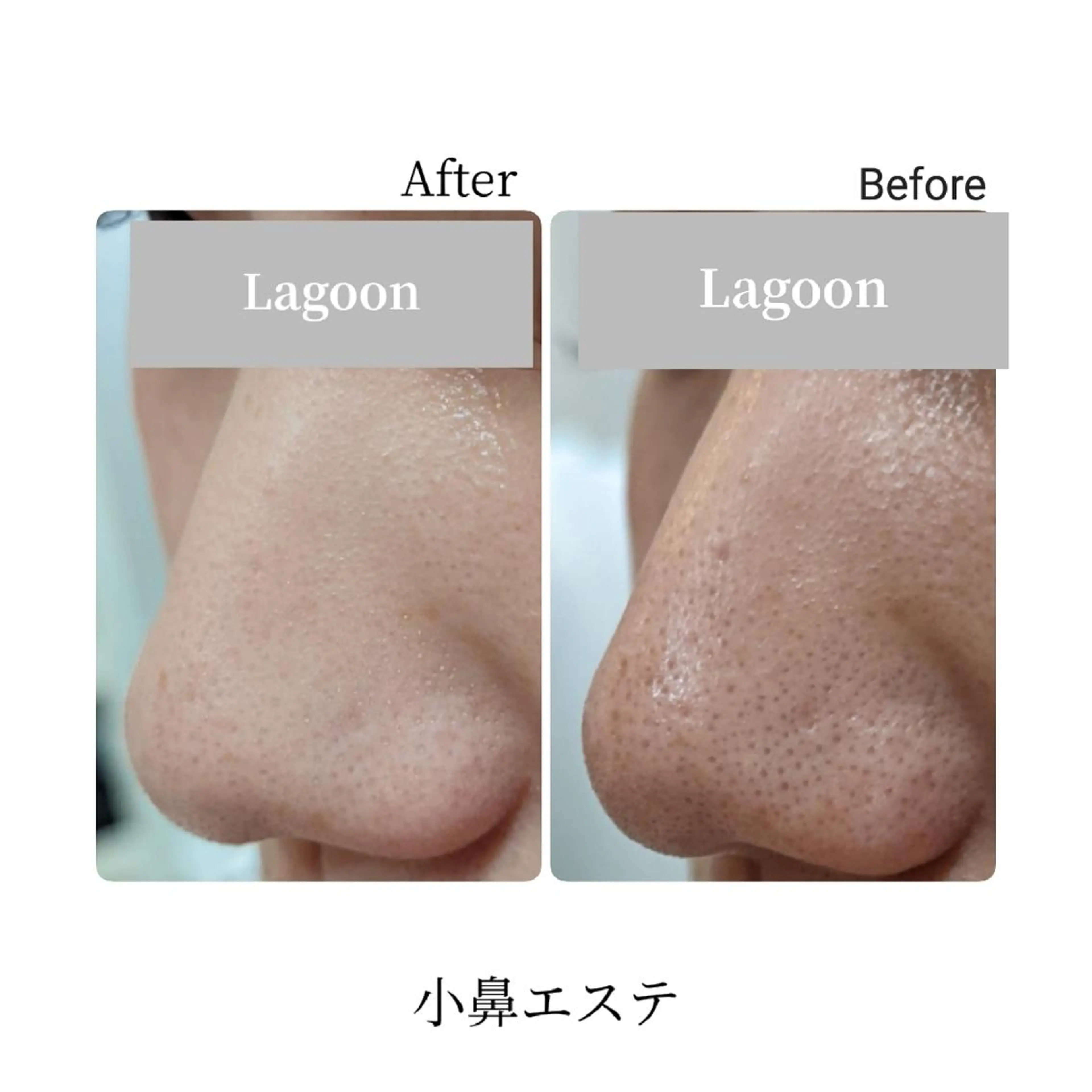 脇山 千佳のエステ・リラクイメージ