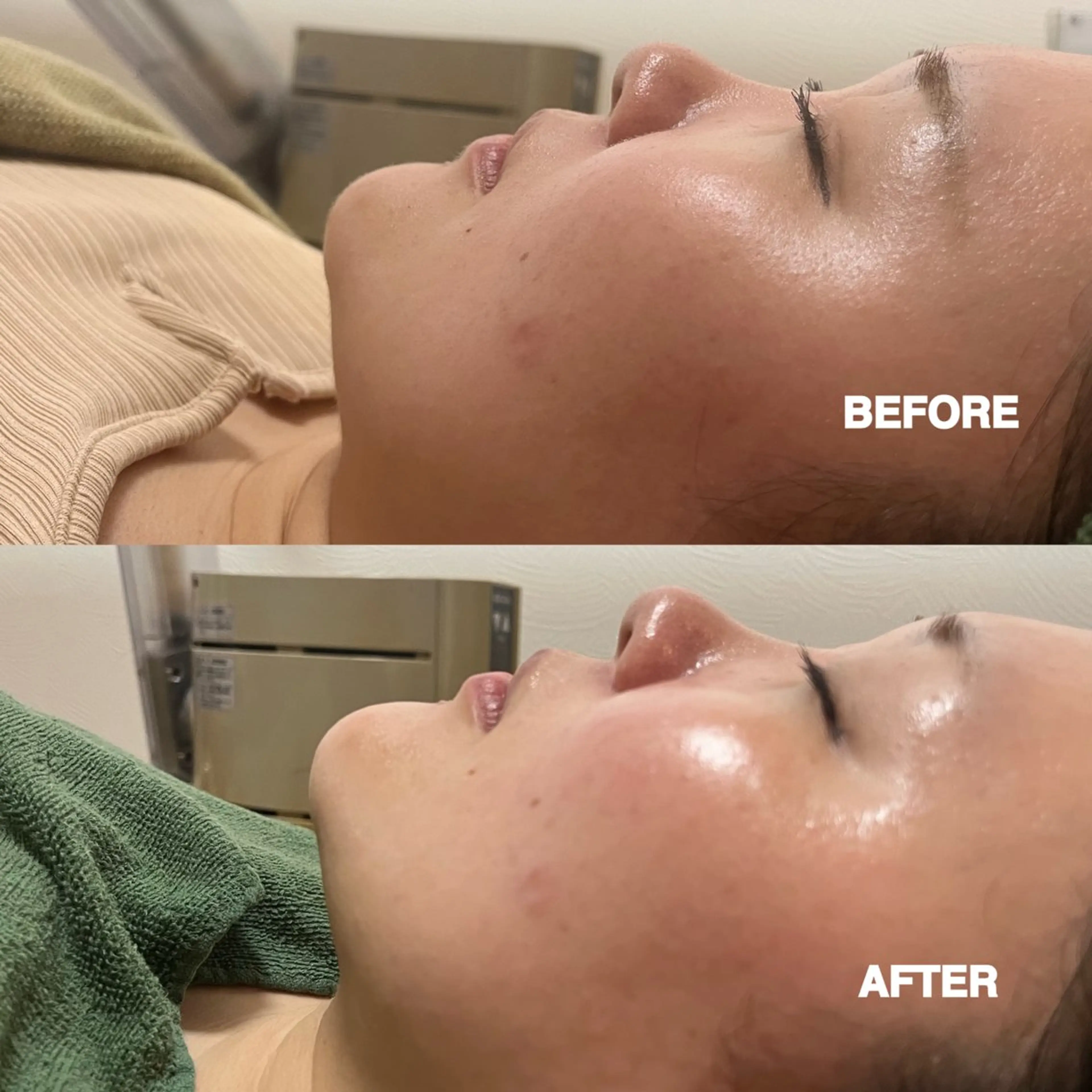 【シェービング＋マッサージ】　　　　　※オイル使用の写真