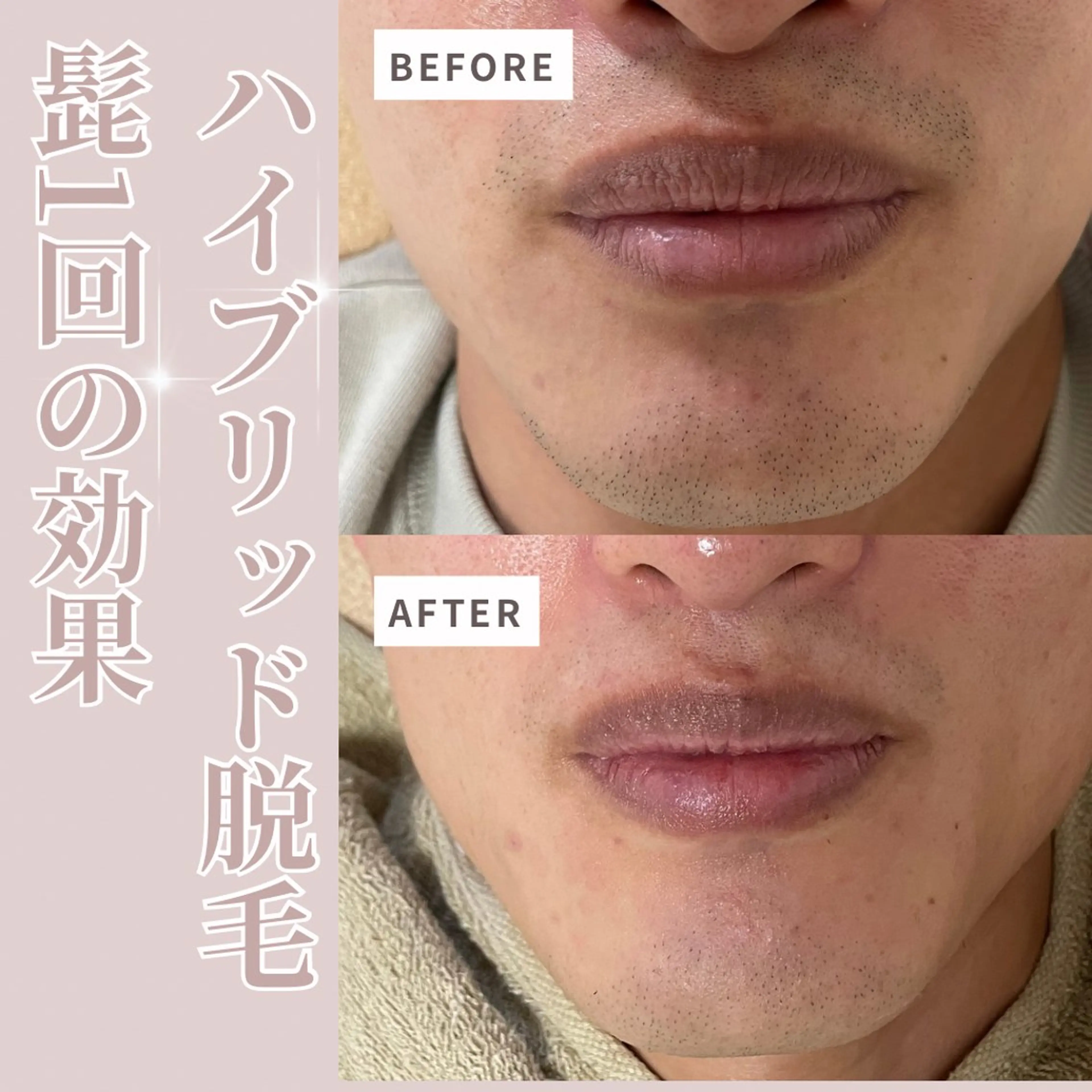 脱毛 プライベートサロン Belle（ベル）のエステ・リラクイメージ