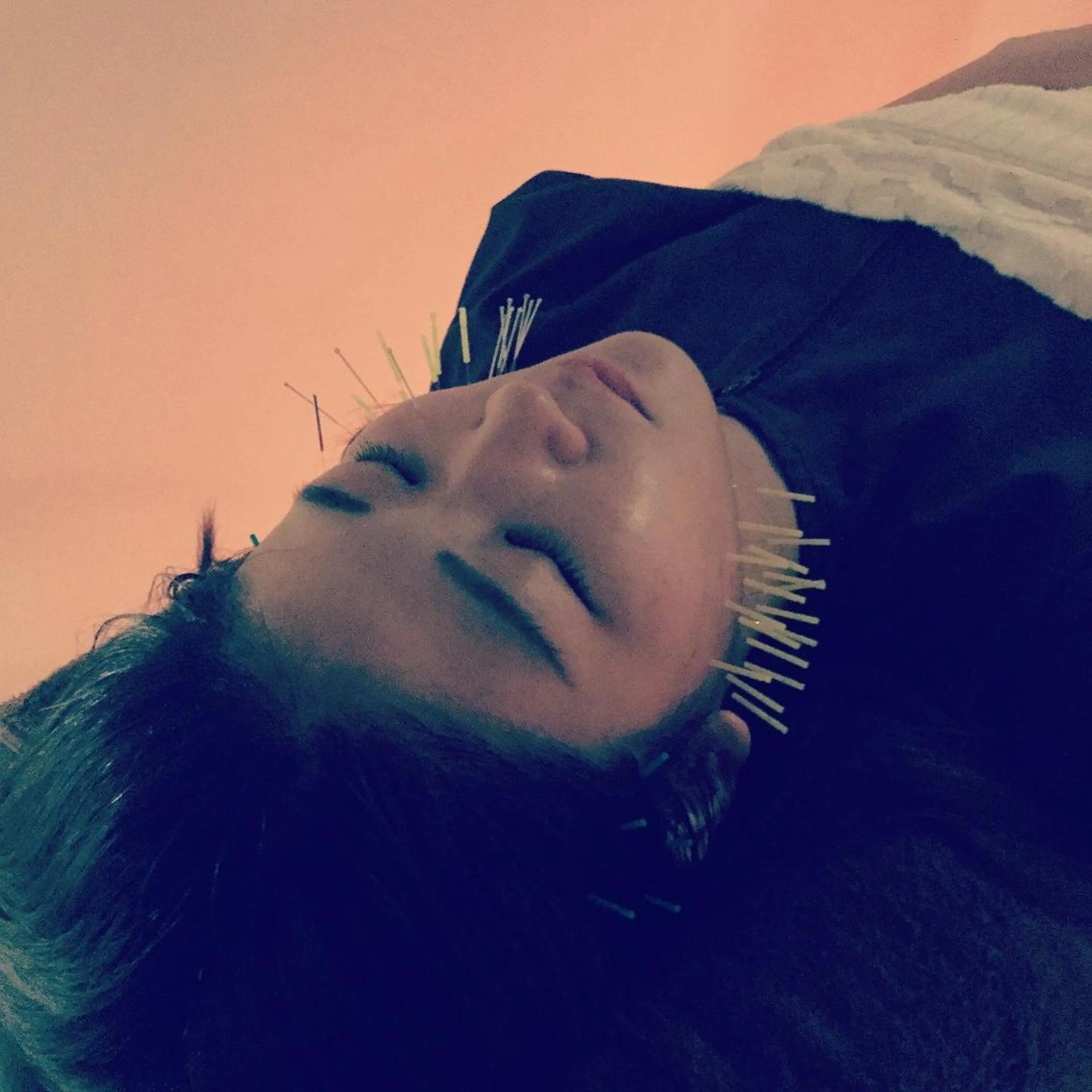 小顔矯正&美容鍼 東洋健美のエステ・リラクイメージ