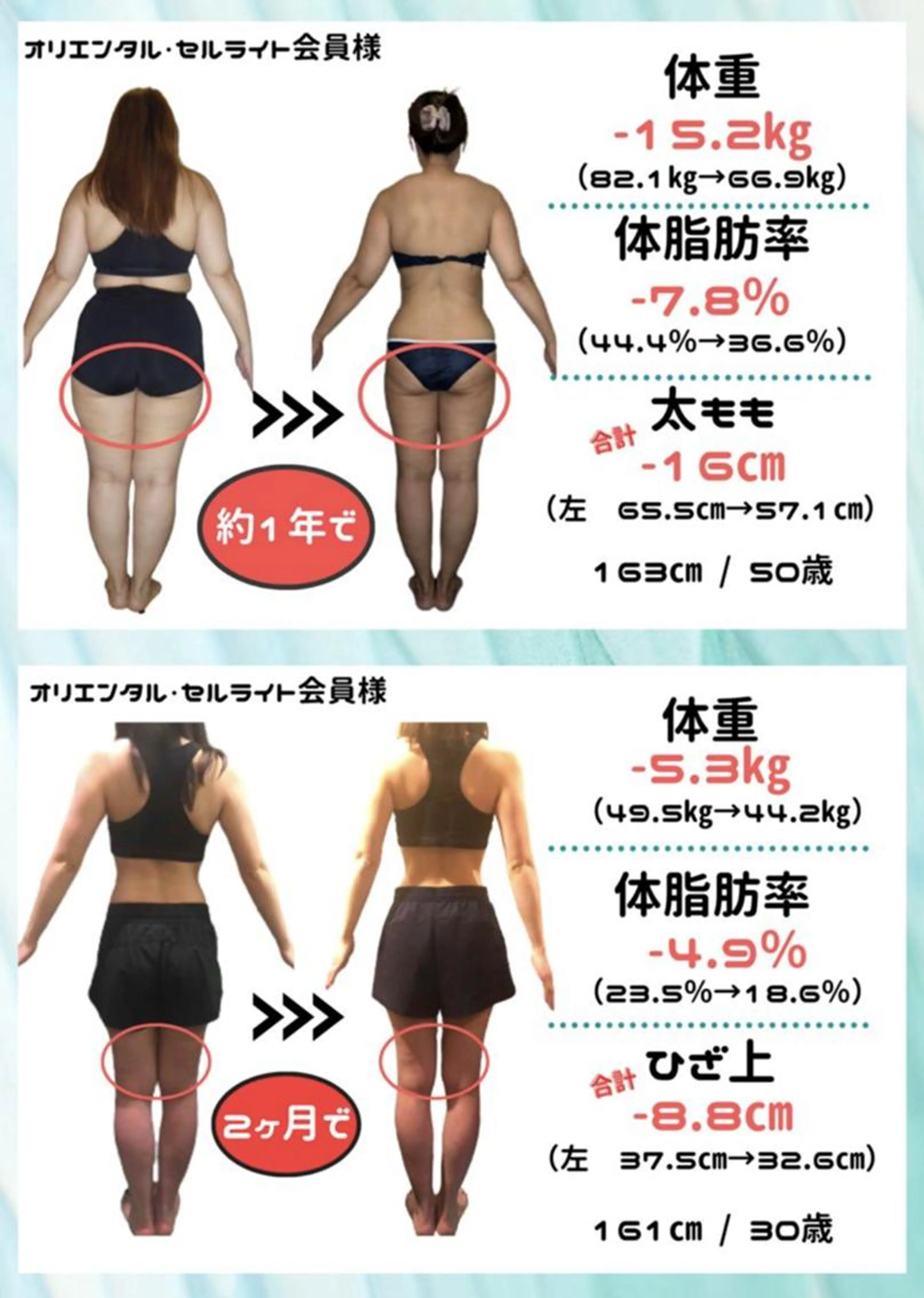 <A相談>[¥66,000で10kg減量まで♪]全身痩身!目標体重まで無期限通い放題コース+3年補償★150分¥0の写真
