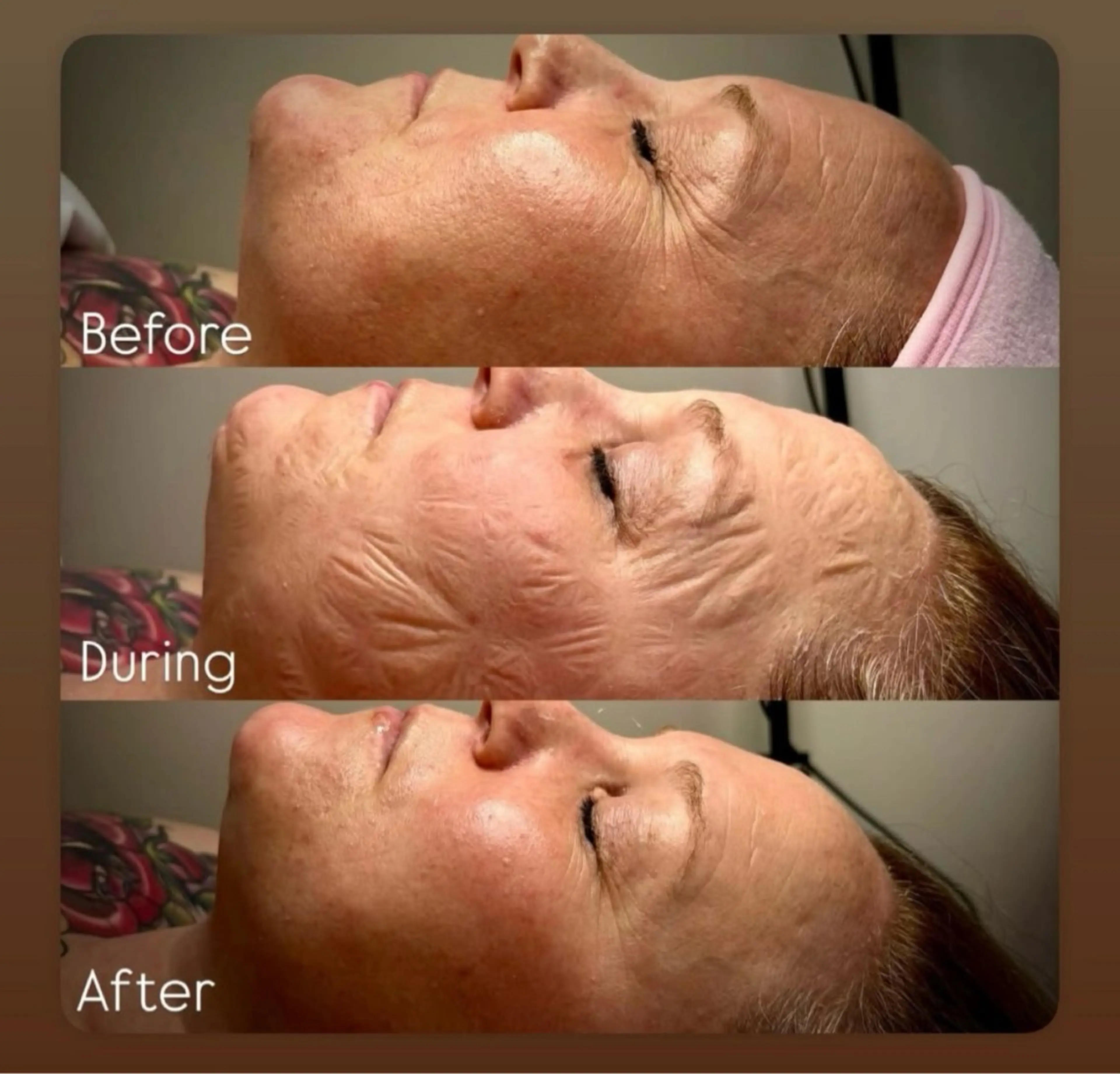 エステ 艶肌ワックス ALLY.のエステ・リラクイメージ