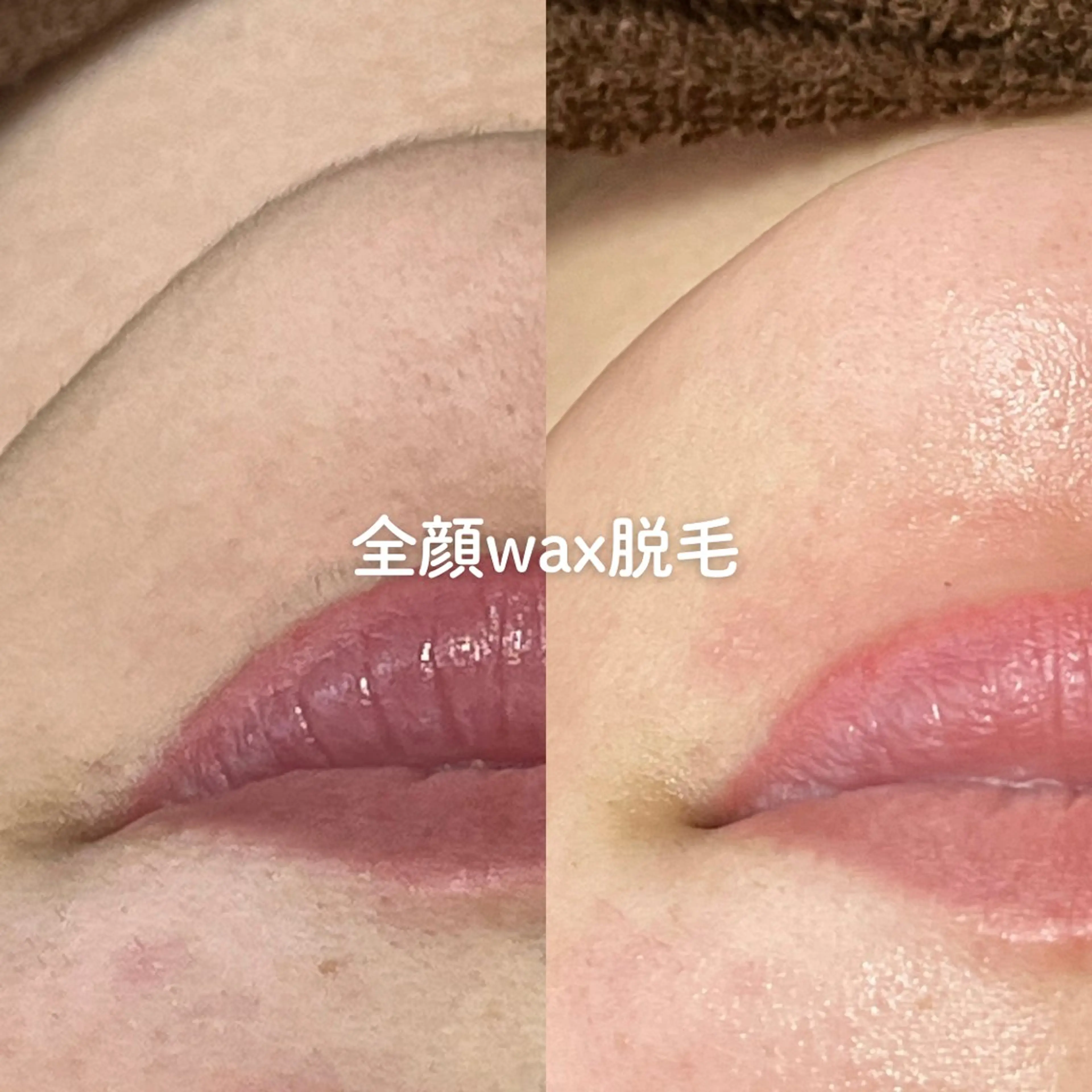 EST BEAUTY所属・顔ワックス脱毛/ ハーブピーリングのエステ・リラクイメージ