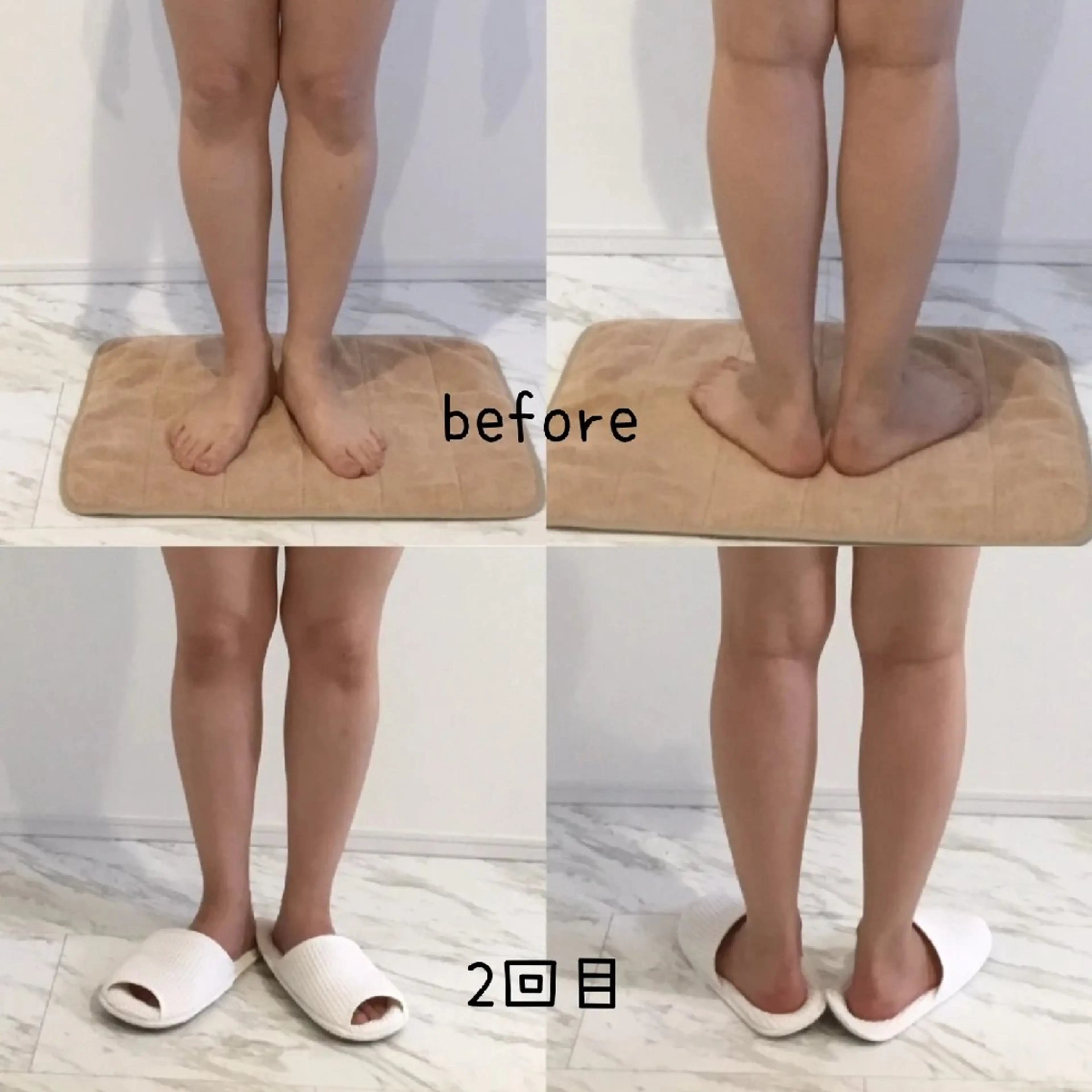 フォースカッター痩身 90分(3部位)の写真