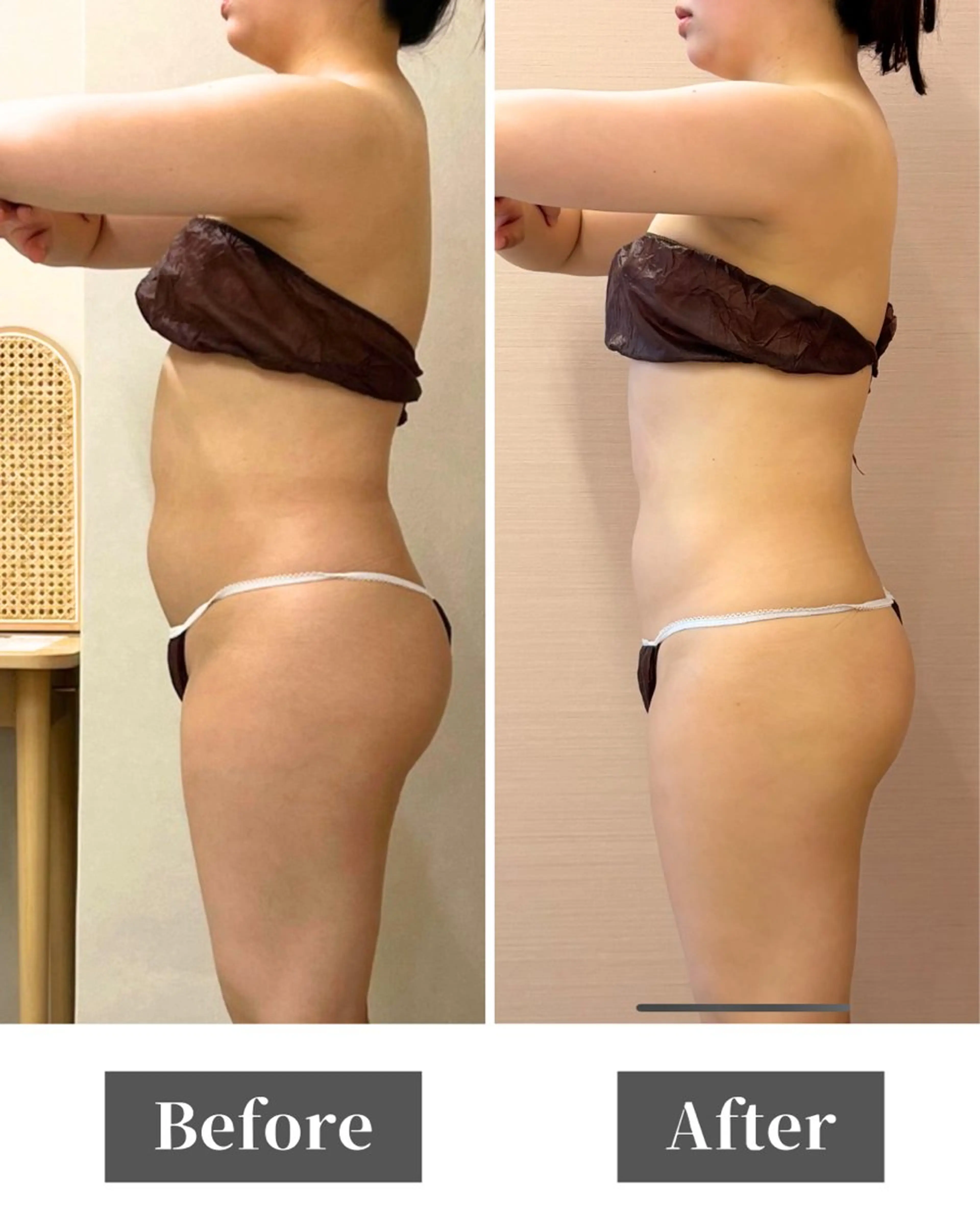 姿勢矯正専門店Asmy天王寺店所属・Asmy 天王寺のエステ・リラクイメージ