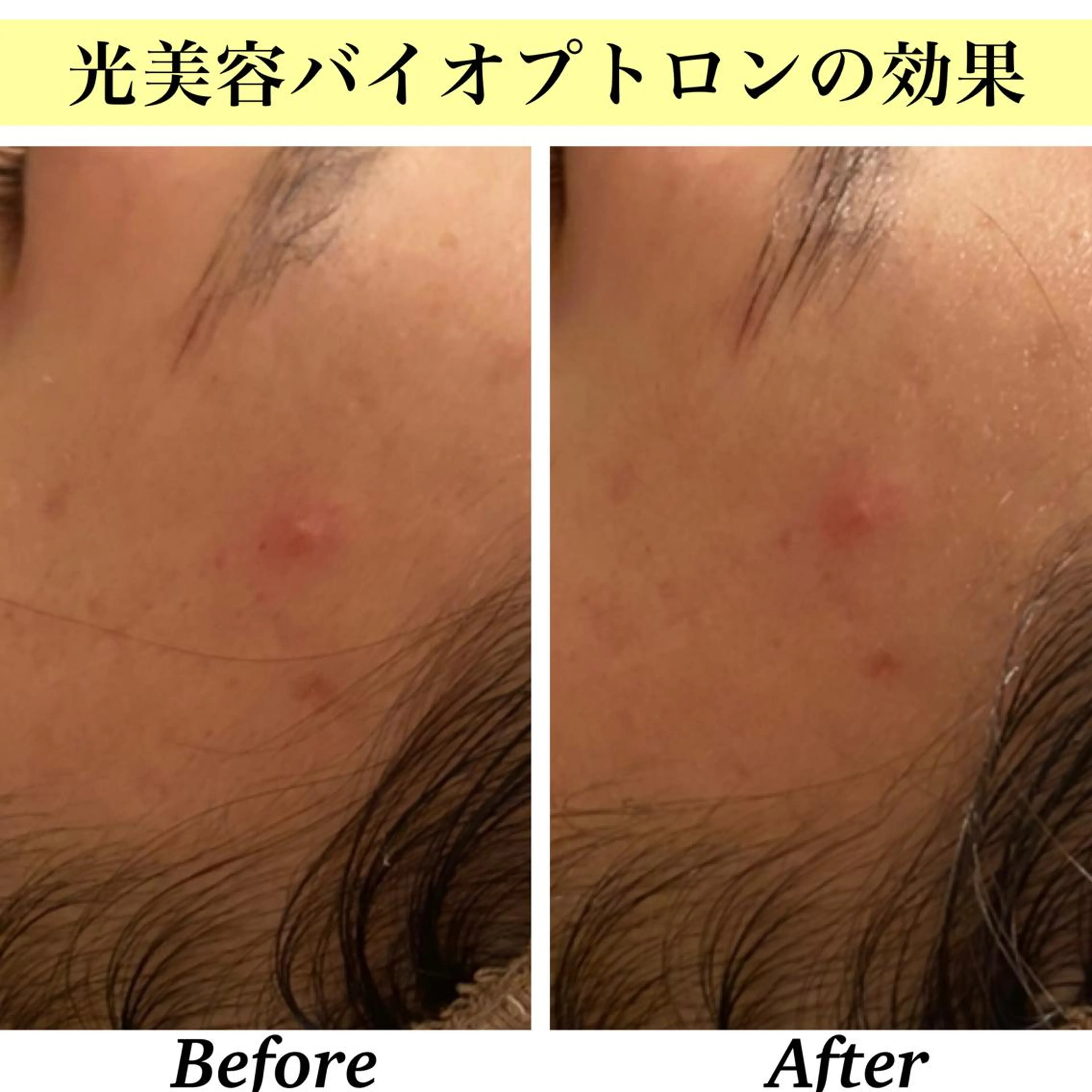 エステ リラク Bellesthe （ベルエステ）のエステ・リラクイメージ