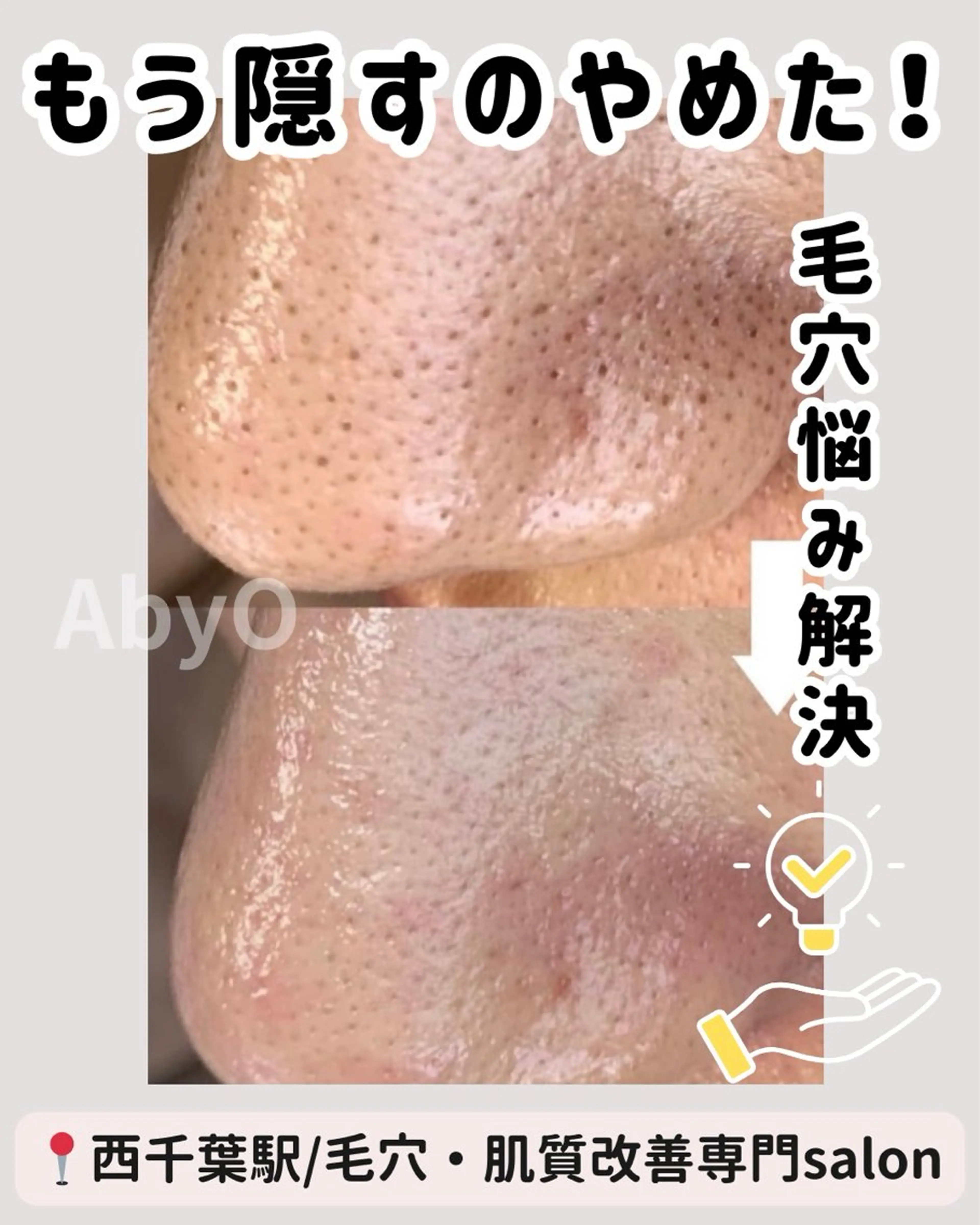 気になる毛穴のお掃除コースの写真