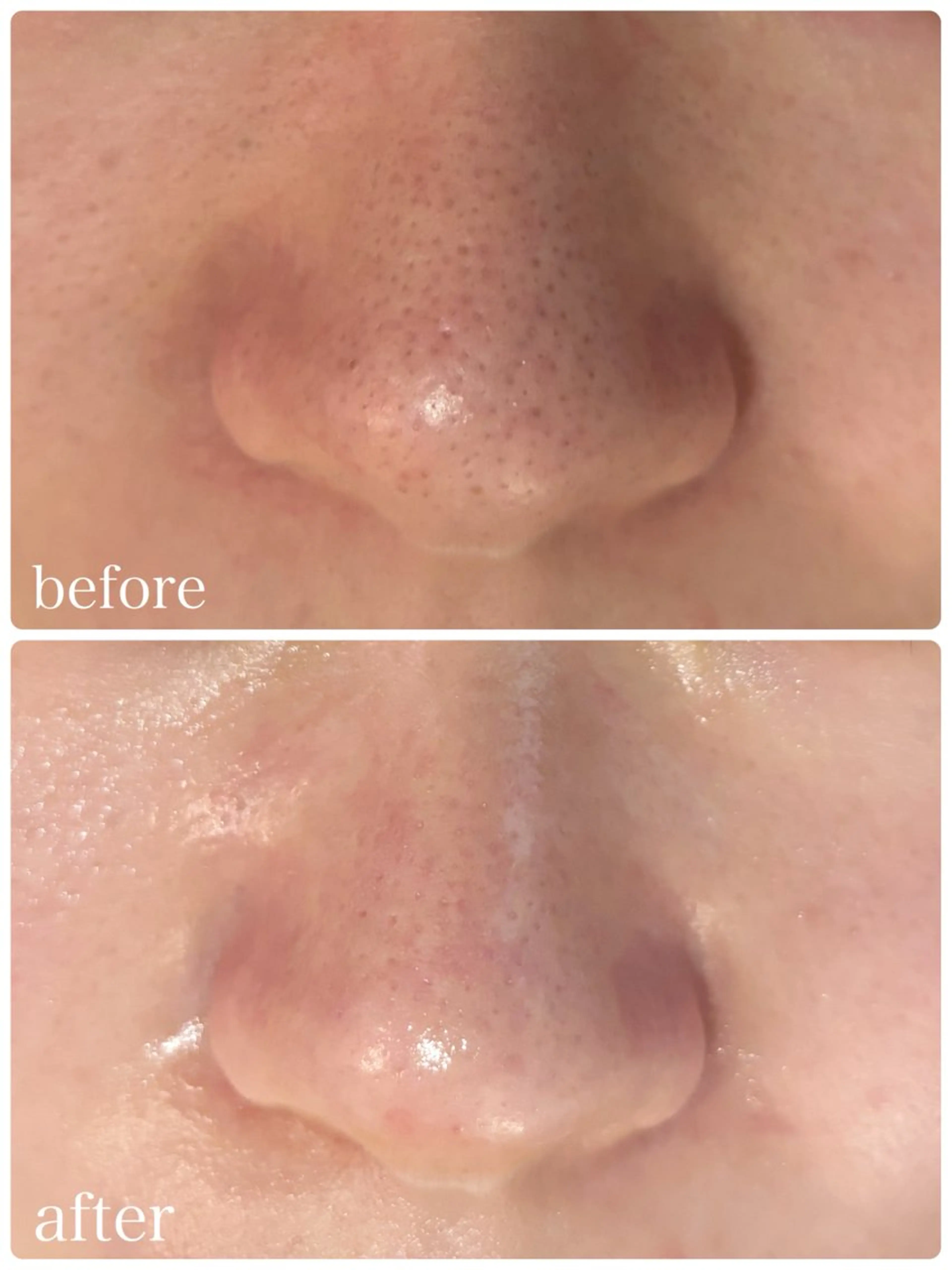 エステ 毛穴シミ改善専門 サロンド・ルパークのエステ・リラクイメージ