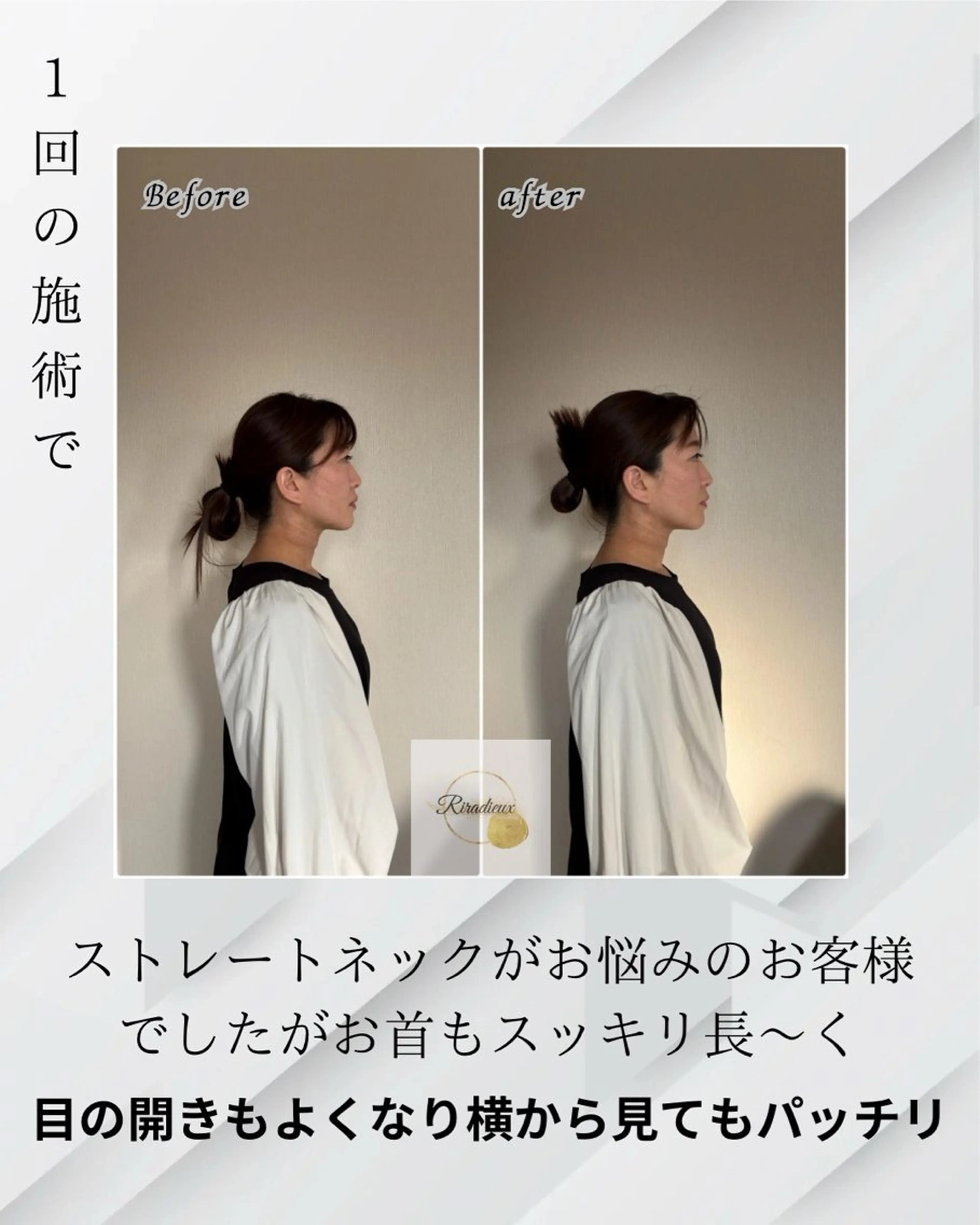 Riradieux ﾘﾗﾃﾞｭ所属・Riradieux 美骨小顔矯正のその他イメージ