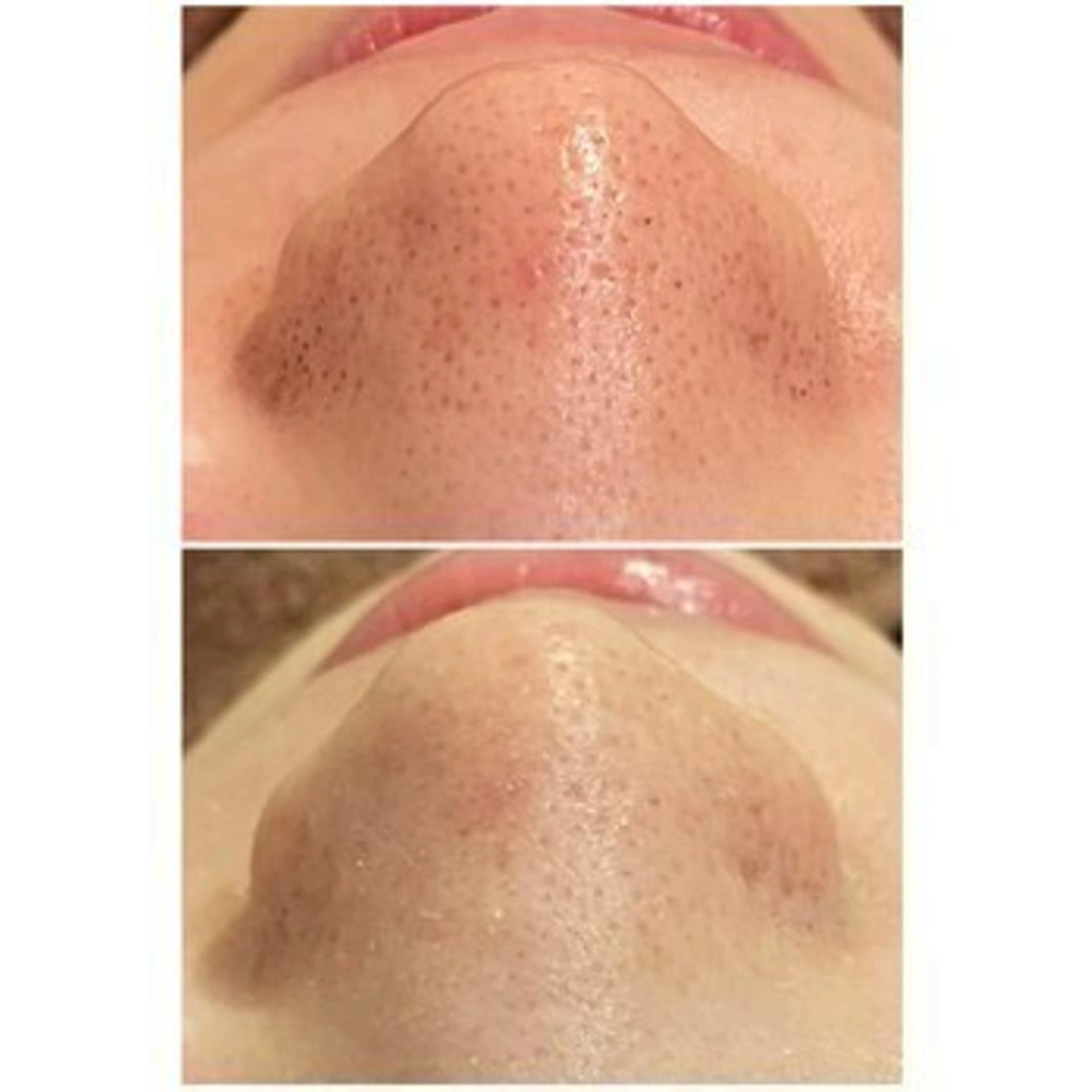 エステ リラク 夏までに肌荒れ卒業 するサロン🌻のエステ・リラクイメージ