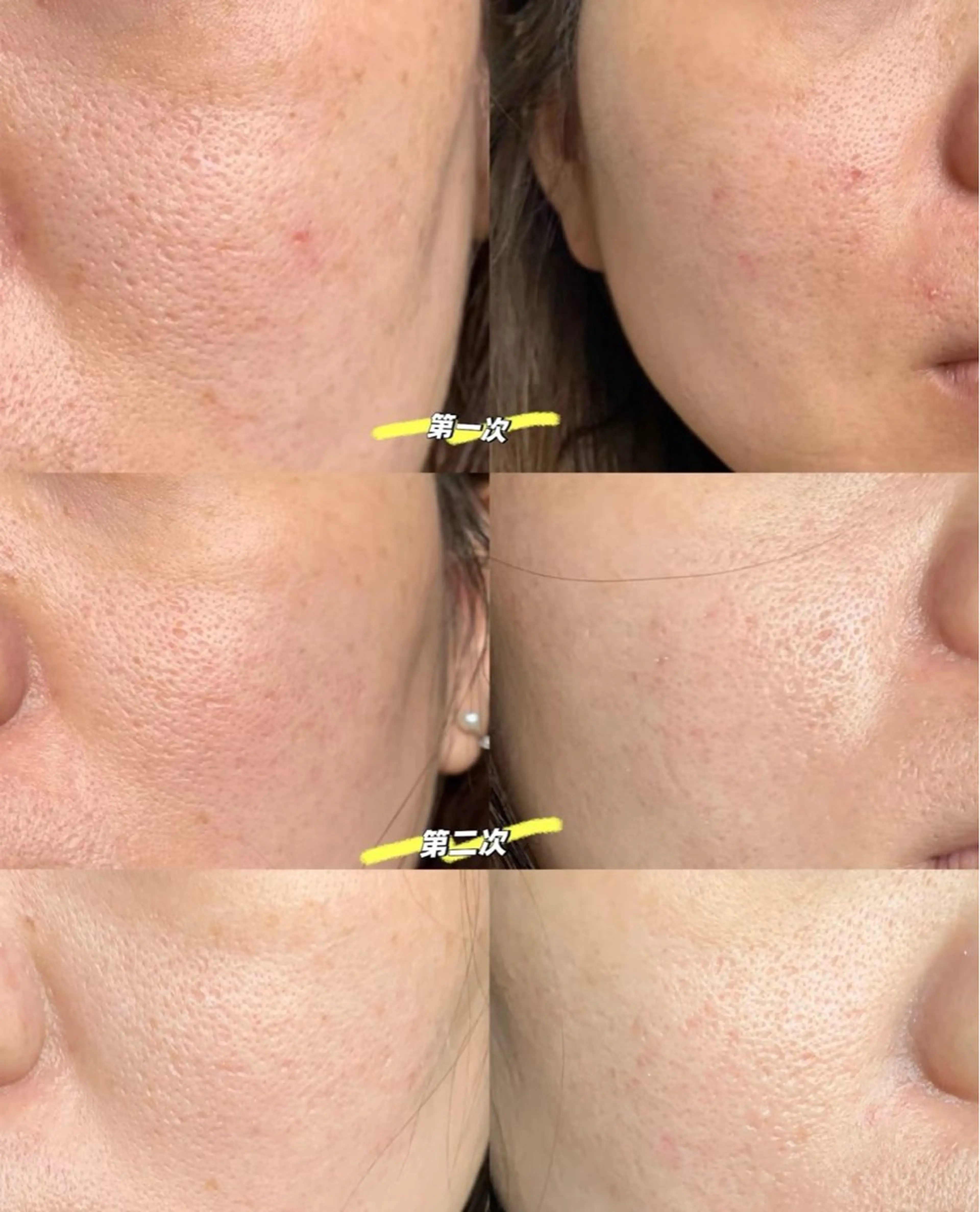 マツエク・マツパ エステ aliaハイフ&水光ジェットサロン所属・aliaハーブ水光店 エステティシャン募集のエステ・リラクイメージ