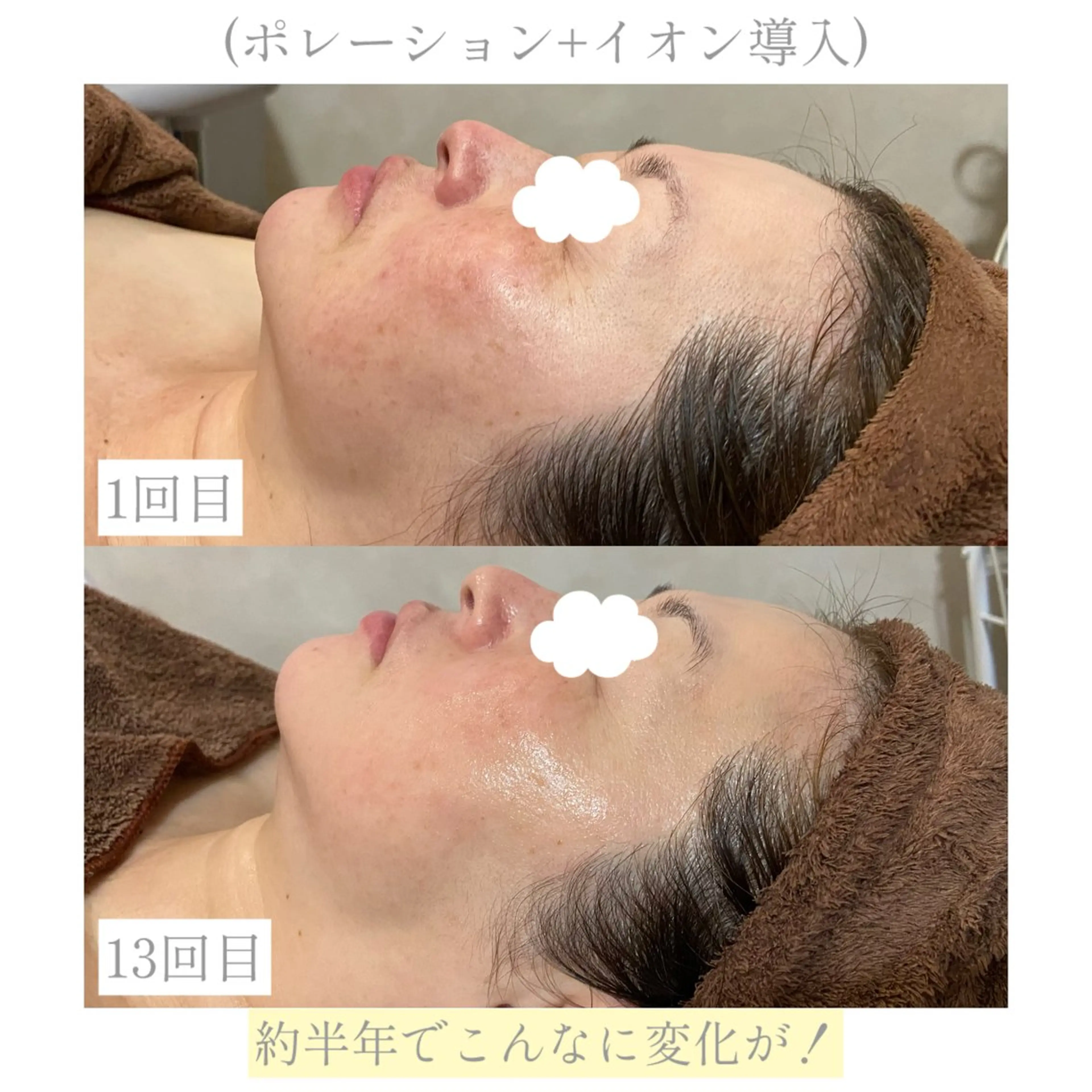 【Folche 春日店】馬場・大内田のエステ・リラクイメージ