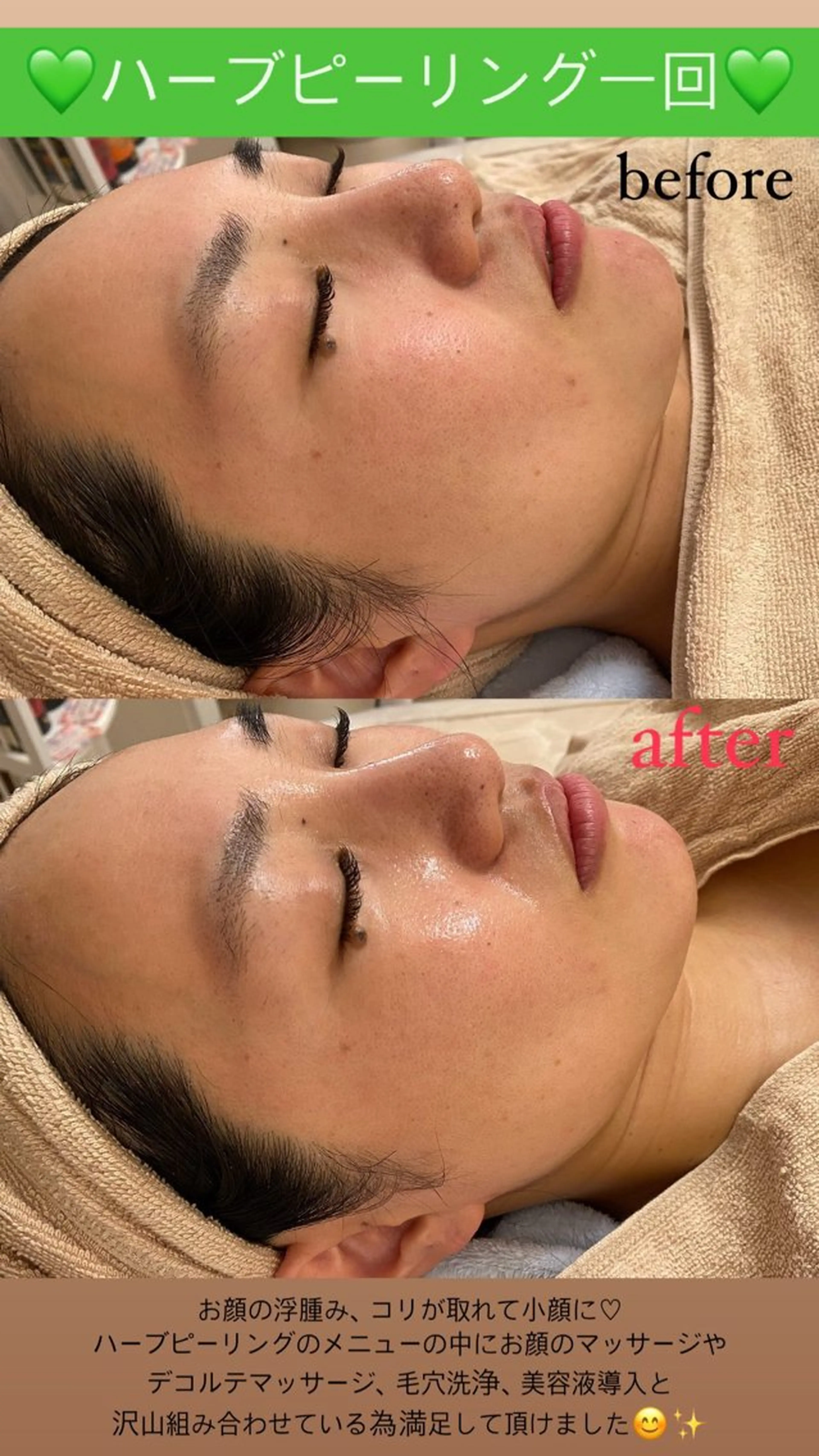 エステ Salon de Lino 御器所のエステ・リラクイメージ