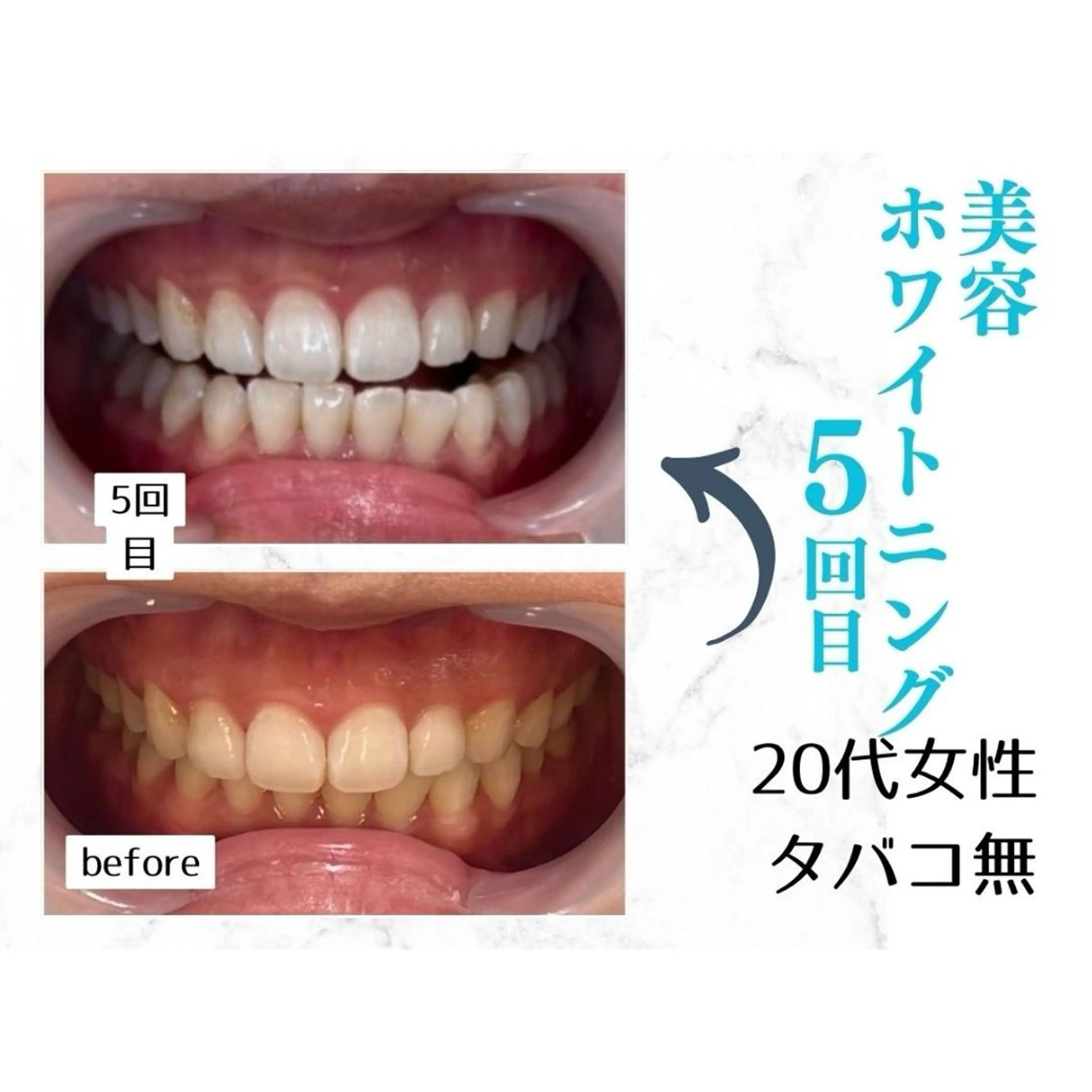 ホワイトニングサロン le  canonのその他イメージ