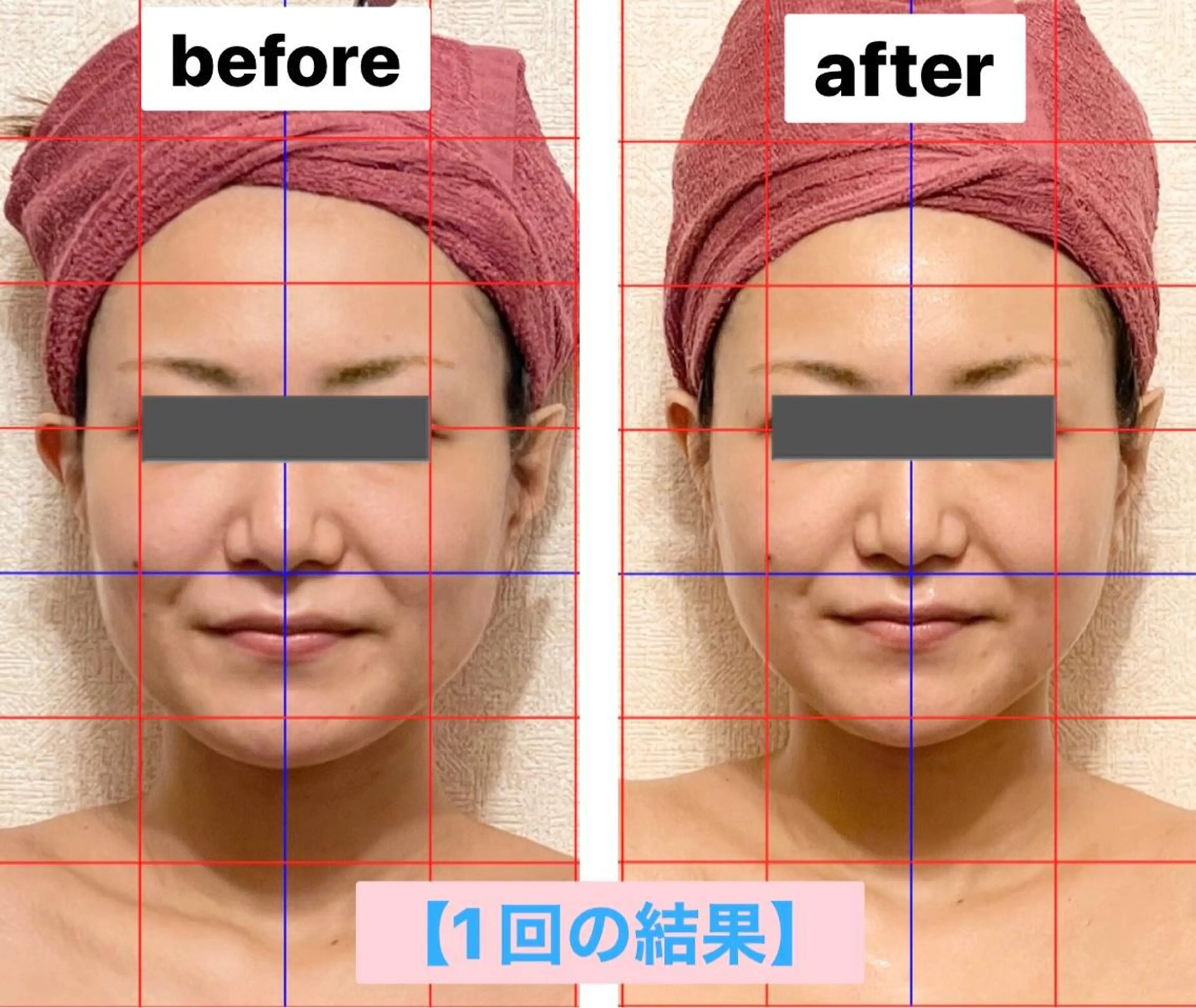 エステ 糸島 エステサロンmiuのエステ・リラクイメージ