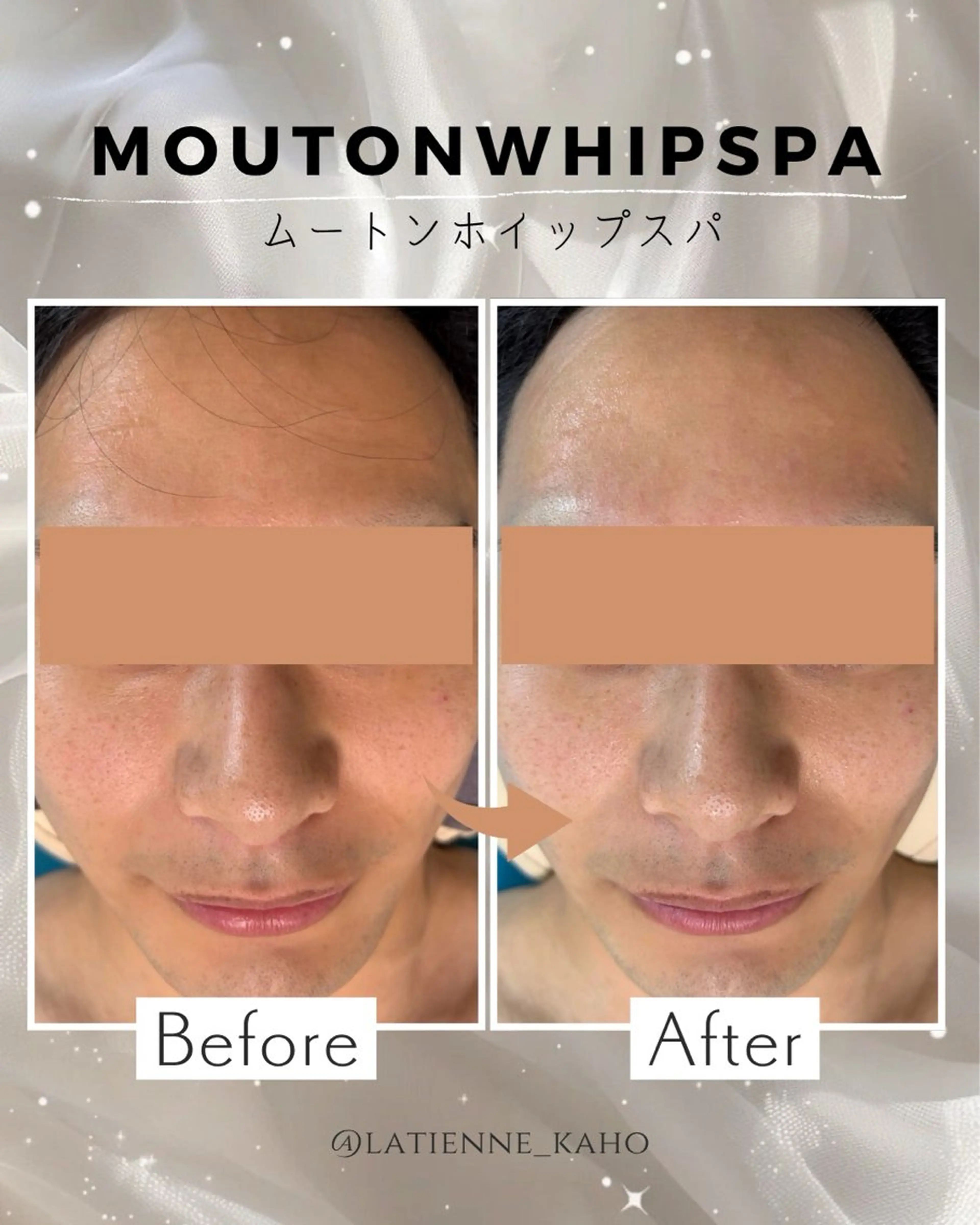 latienne所属・latienne kahoのエステ・リラクイメージ