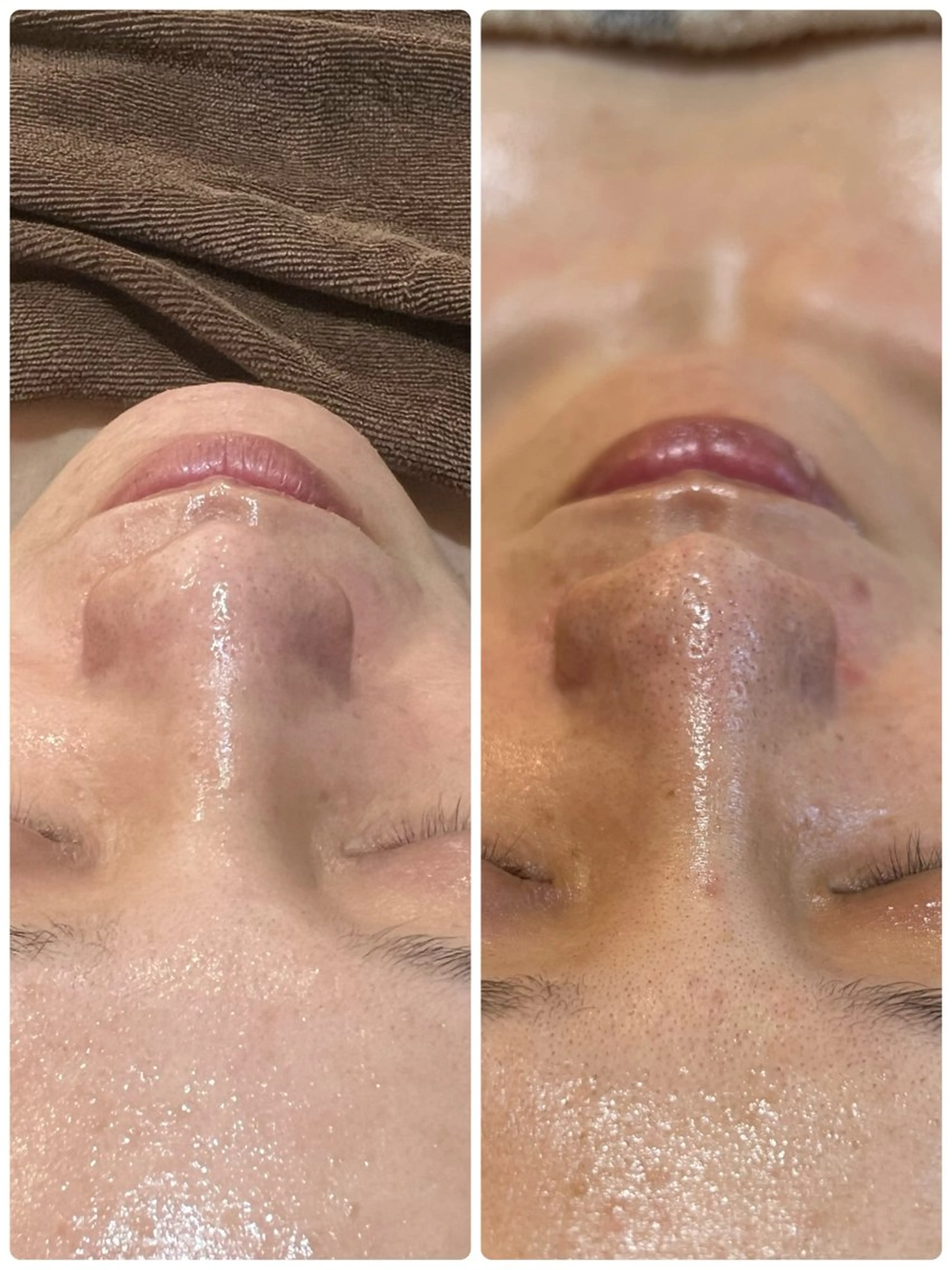 エステ ハーブ/小顔/リンパ /大阪狭山市のエステ・リラクイメージ