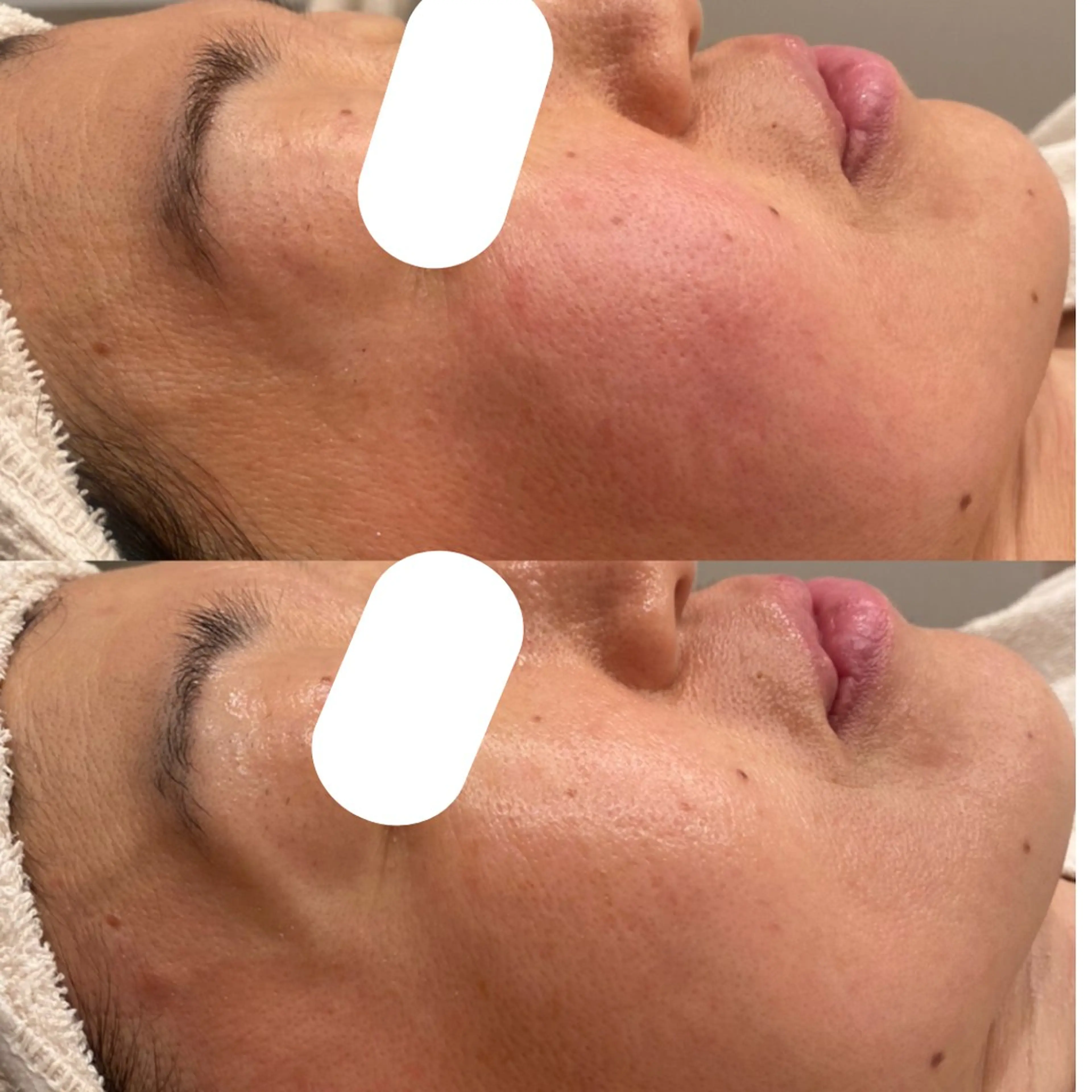 エステ リラク 田中For..天王寺 肌質改善/よもぎ蒸しのエステ・リラクイメージ