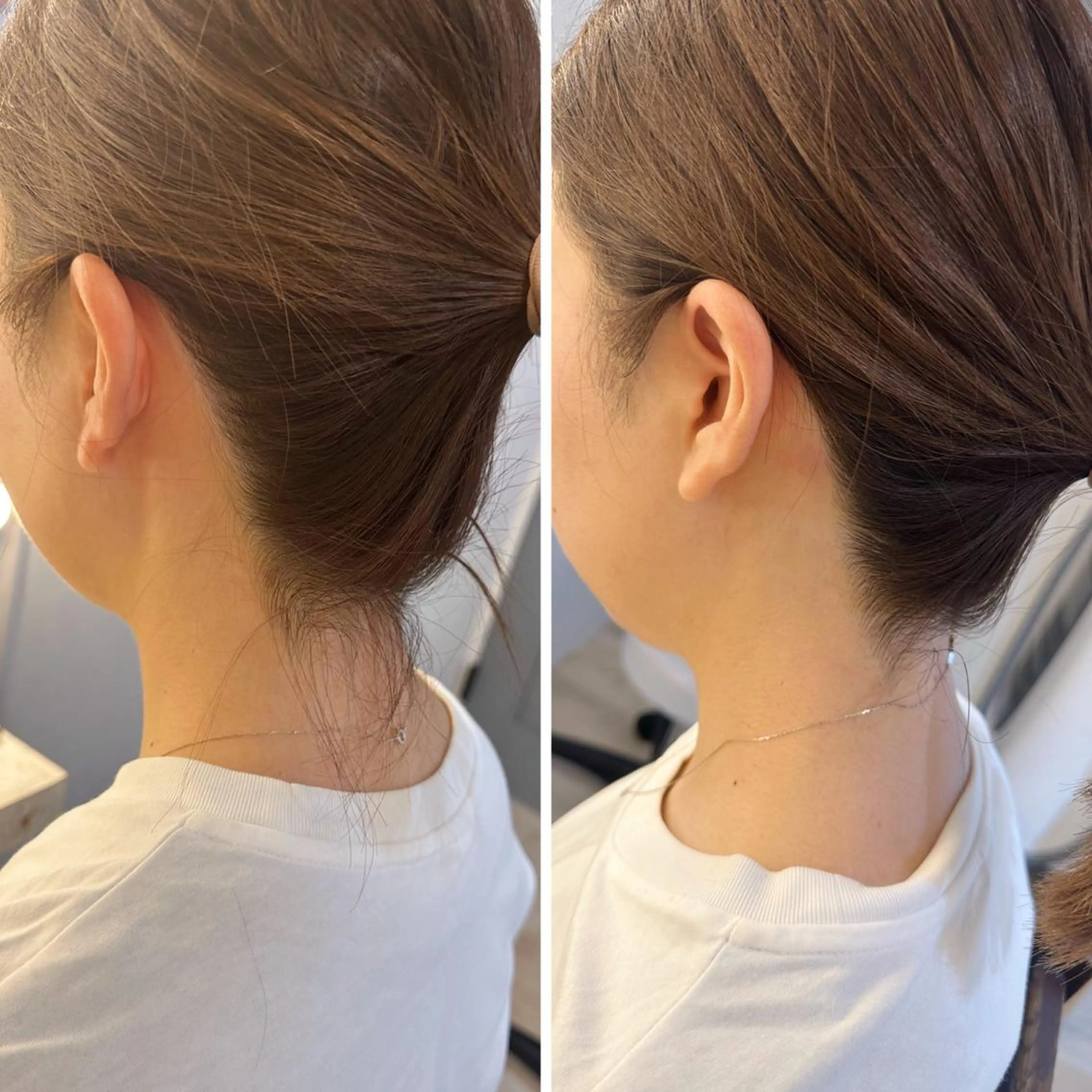 うなじ脱毛/美肌脱毛 LABELのエステ・リラクイメージ