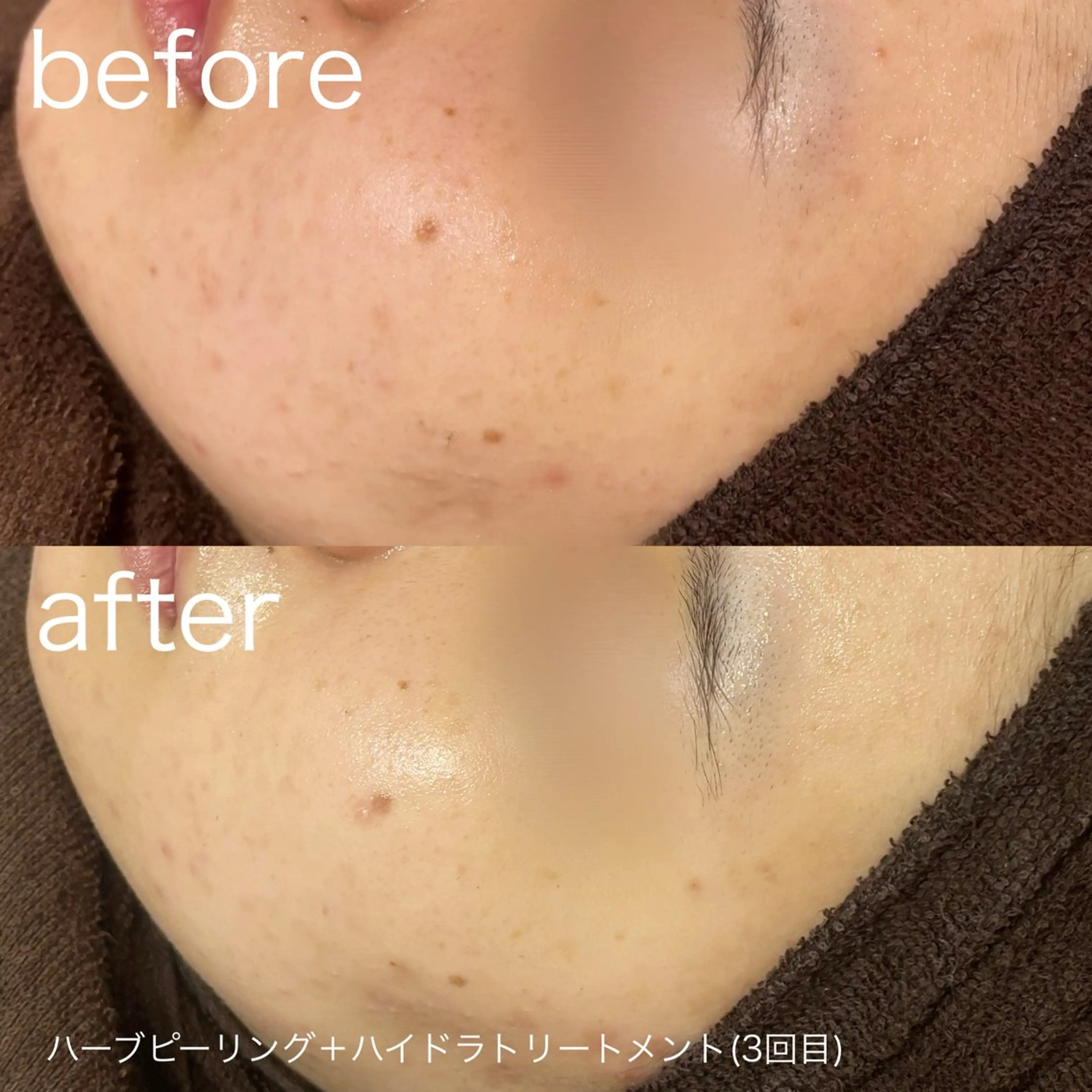 脱毛 lulularico Yuのエステ・リラクイメージ