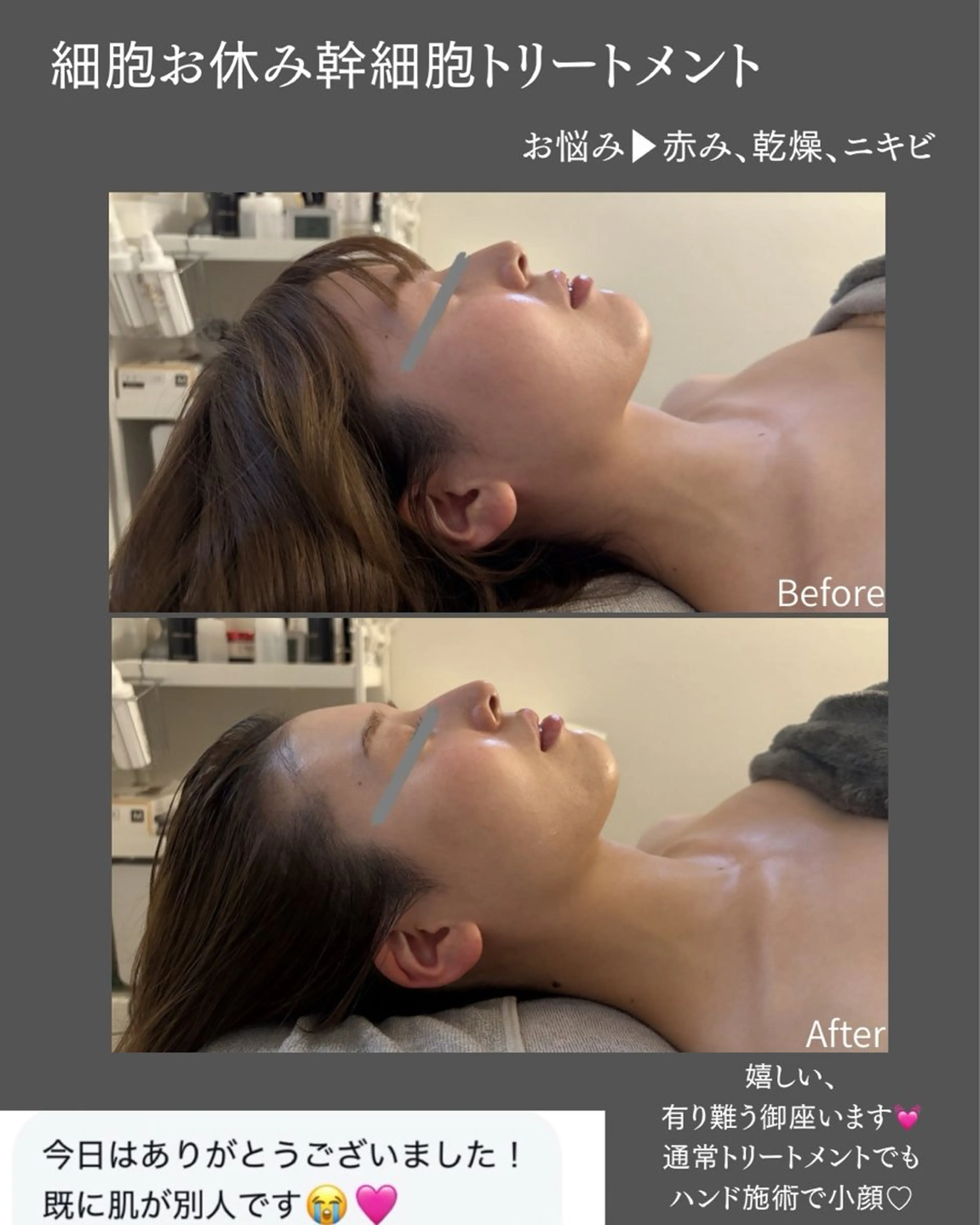 salon BLOSSOMのエステ・リラクイメージ