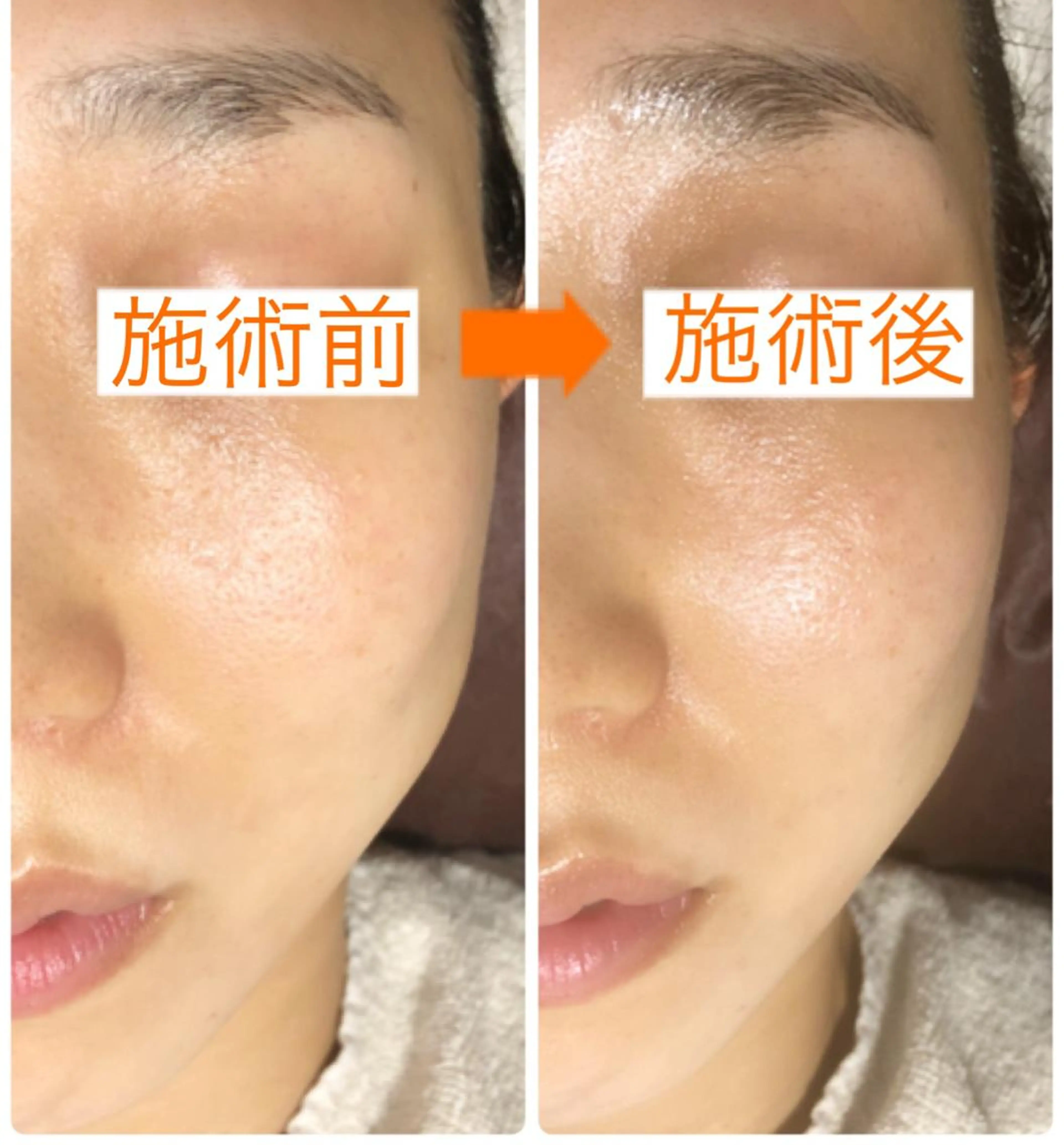 エステ 小顔・毛穴・たるみ ネイル　似内真樹のエステ・リラクイメージ