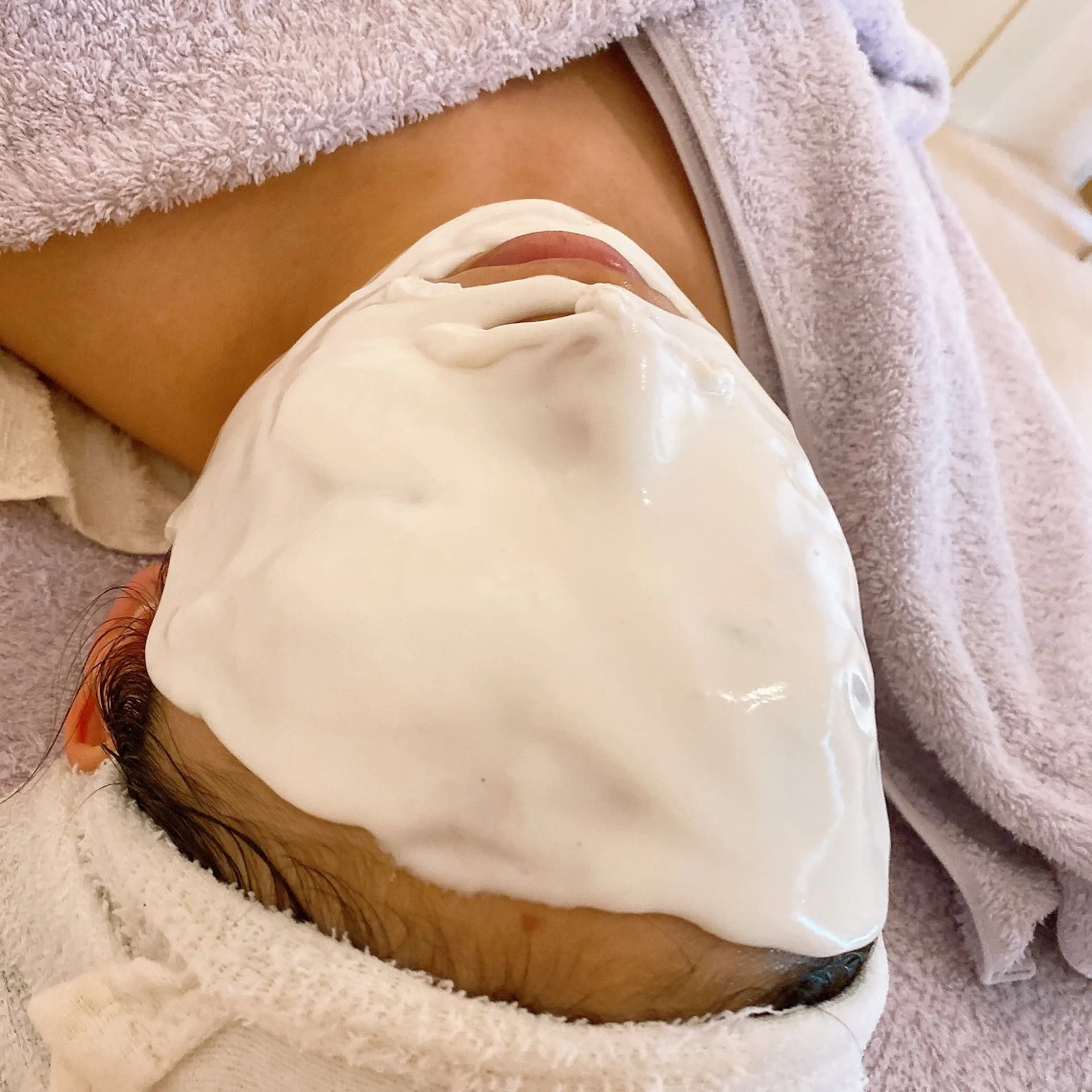 アドバンスコース➕ホワイトニングパックの写真