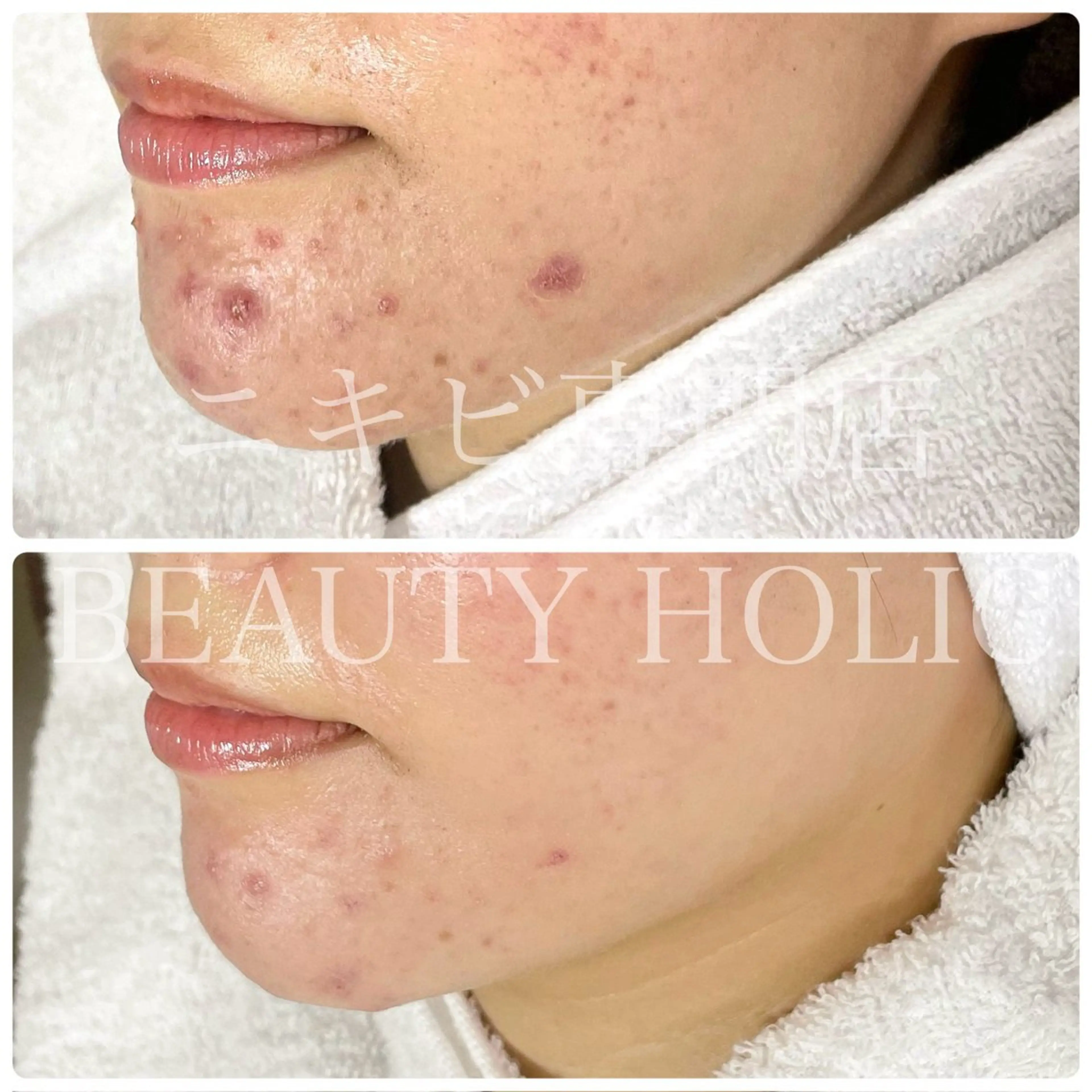 エステ リラク ニキビ・ 肌荒れ専門店のエステ・リラクイメージ