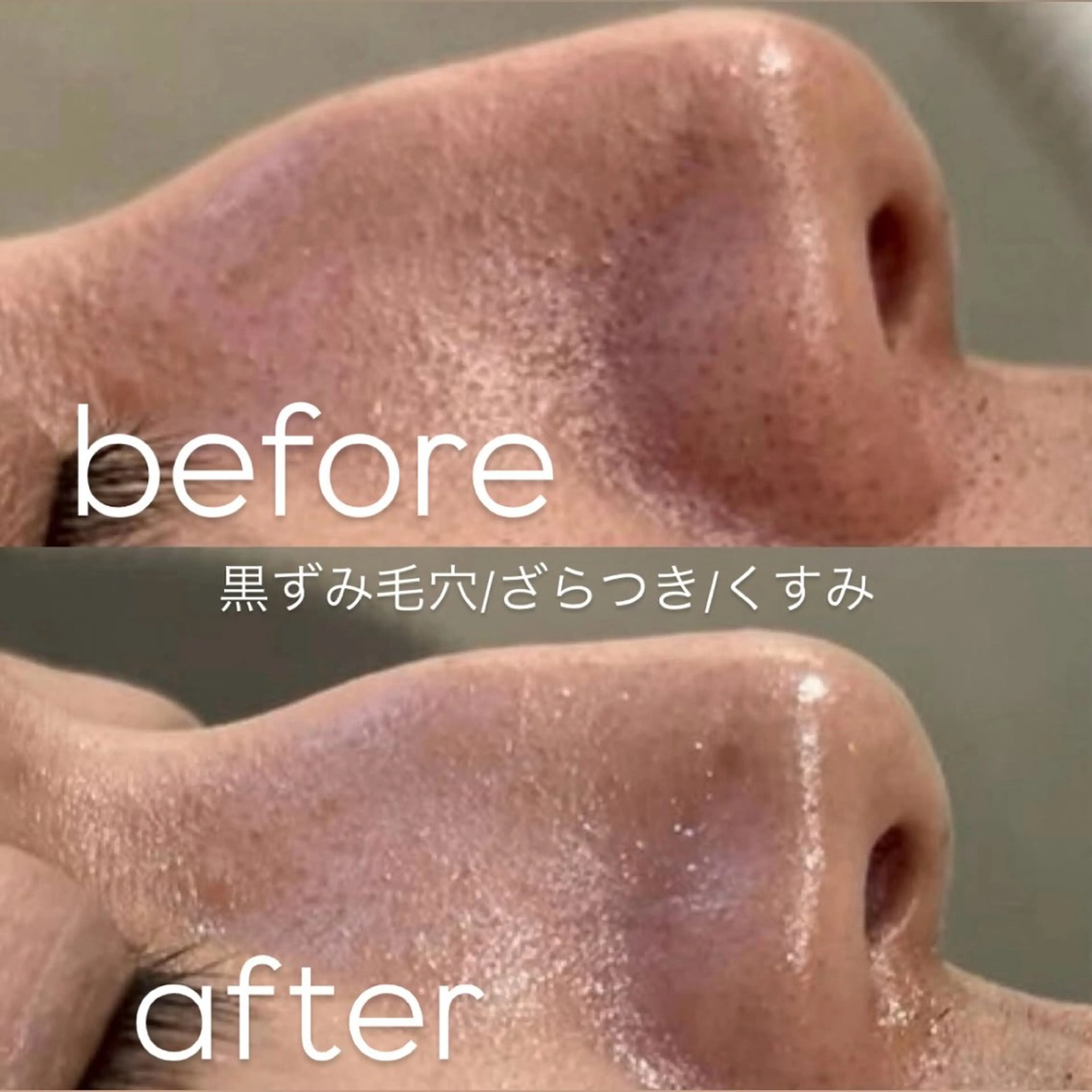 エステ リラク 【vidyto】ヴィディトゥ所属・肌管理サロン vidyto　MOEのエステ・リラクイメージ